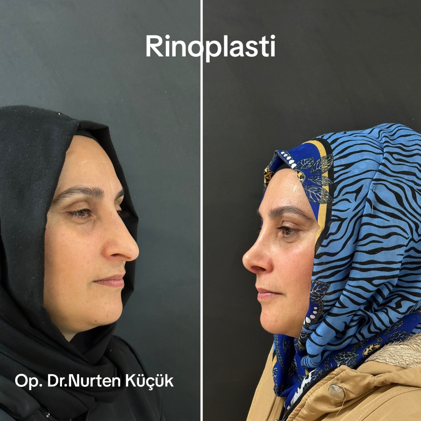 @Dr. NurtenKucuk