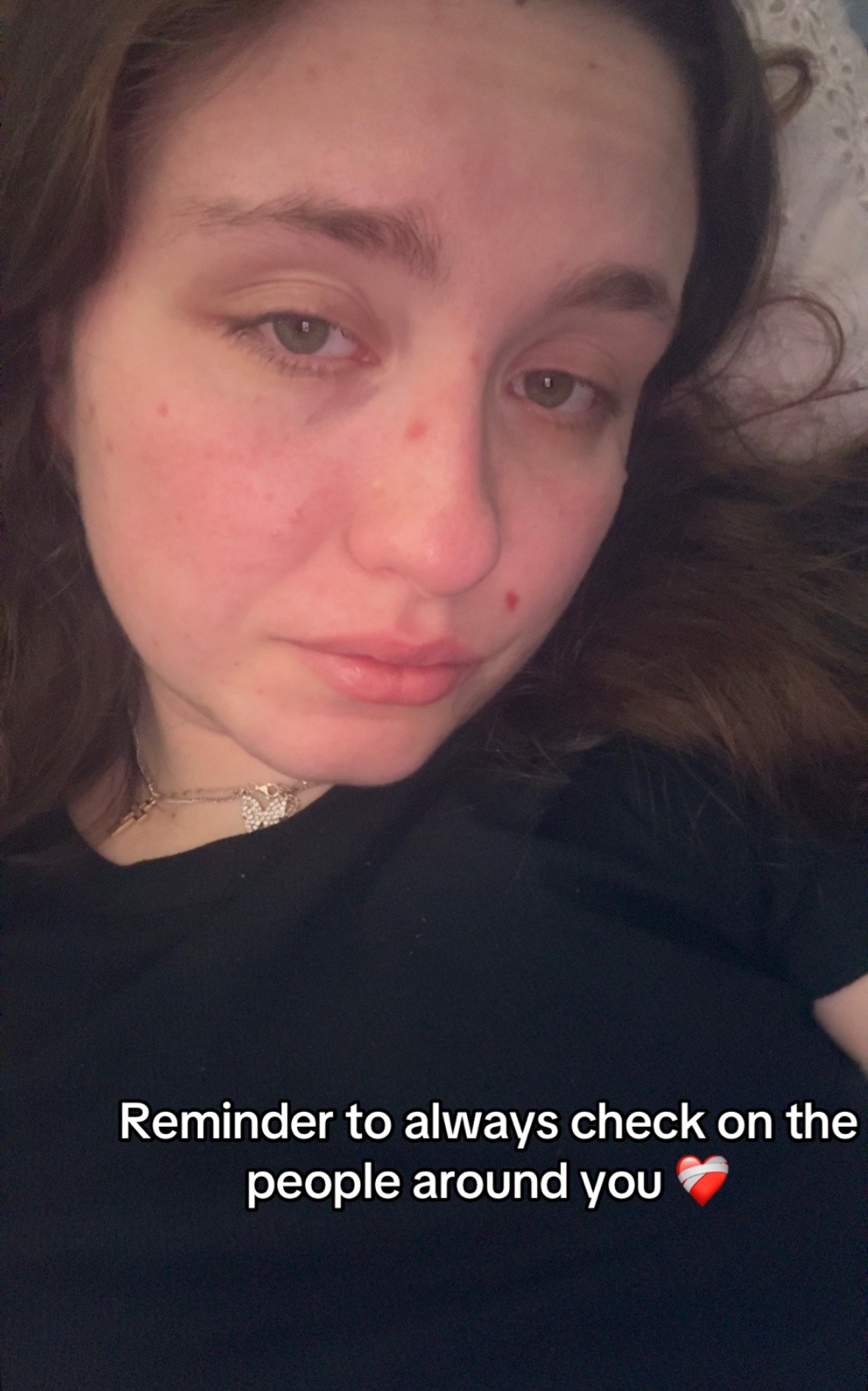 @Kayla<3