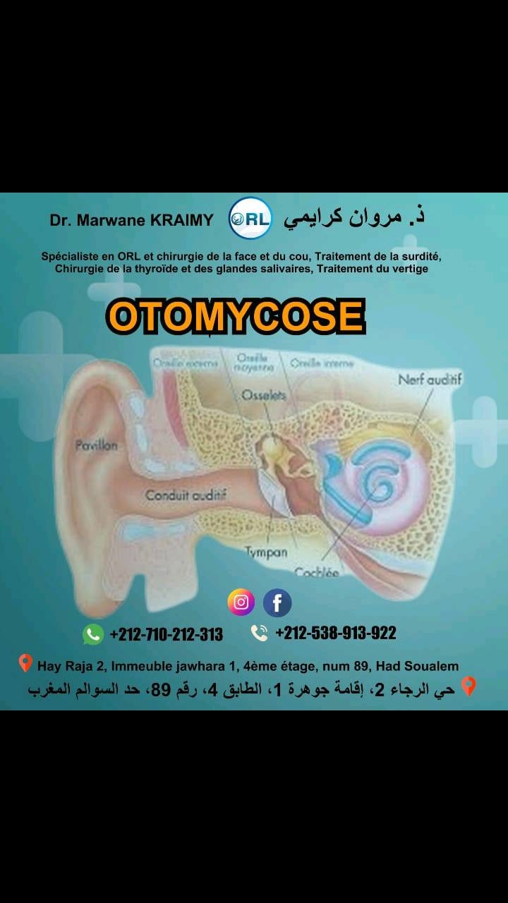 @Dr Marwane ORL
