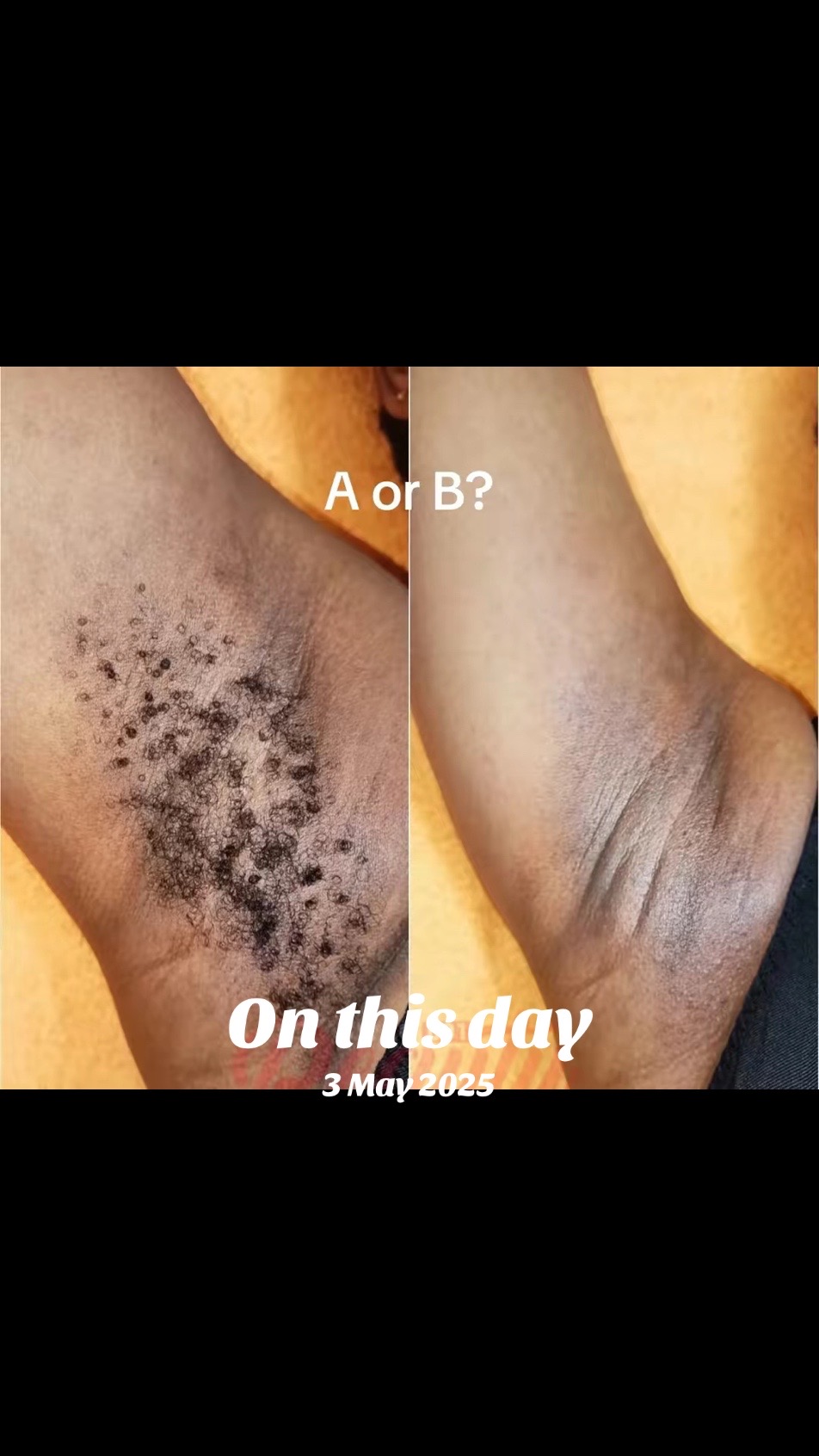 @Women armpit lovers