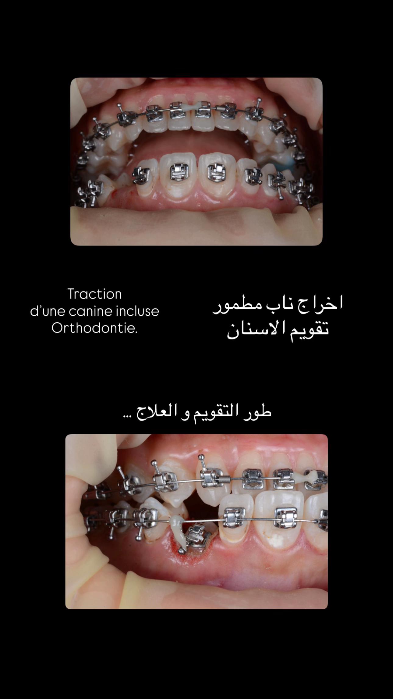 @Dr.tarik_laam