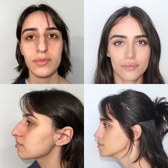 @Xue Skin & Contour