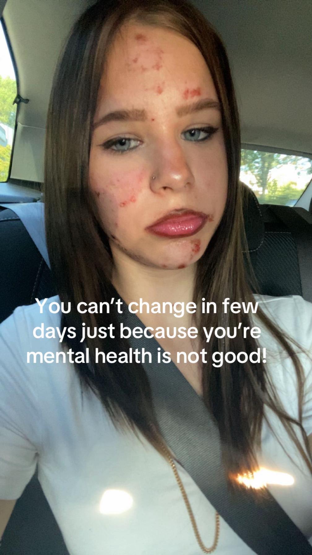 @Elisa