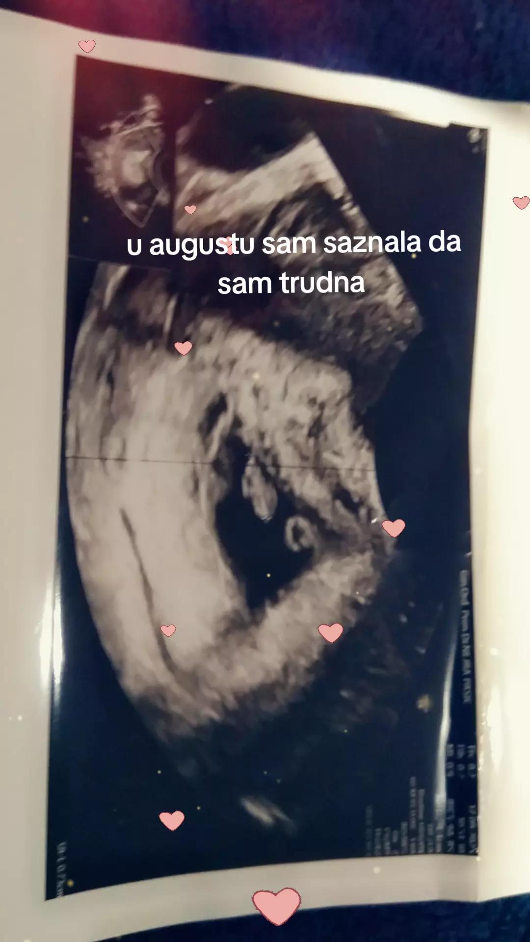 @Jasmina
