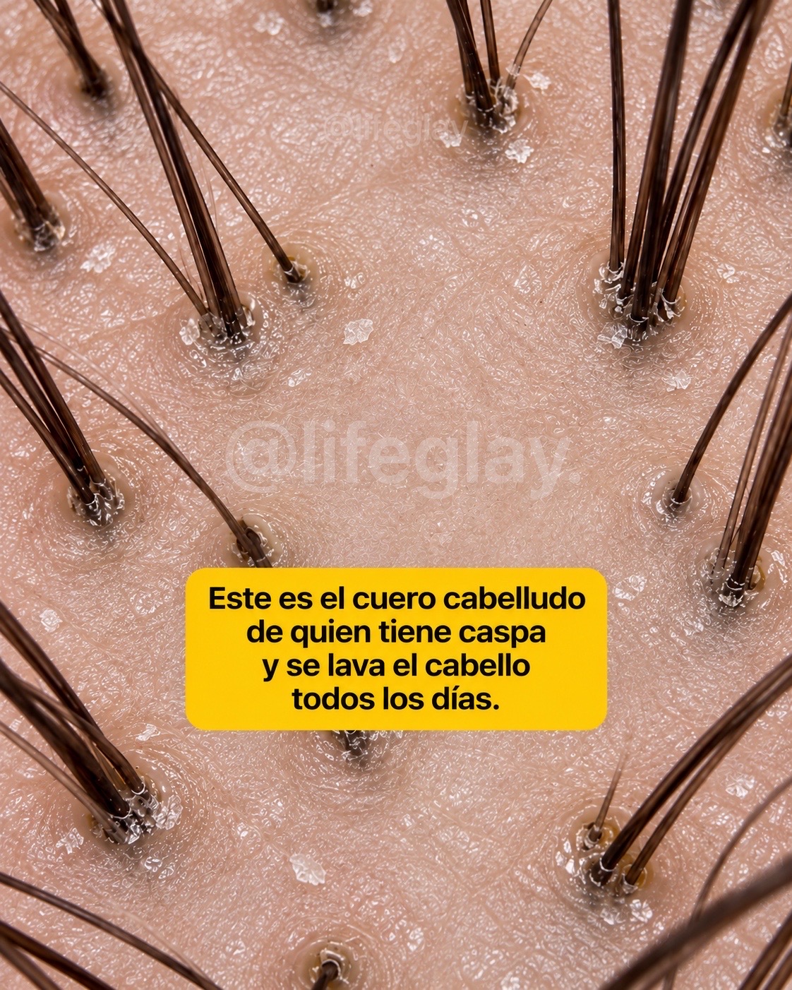 @lifeglay