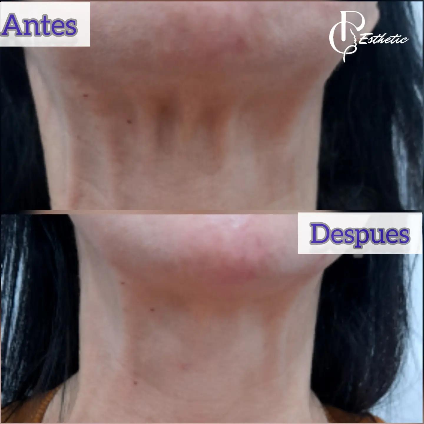 @Medicina Est&eacute;tica y Avanzada