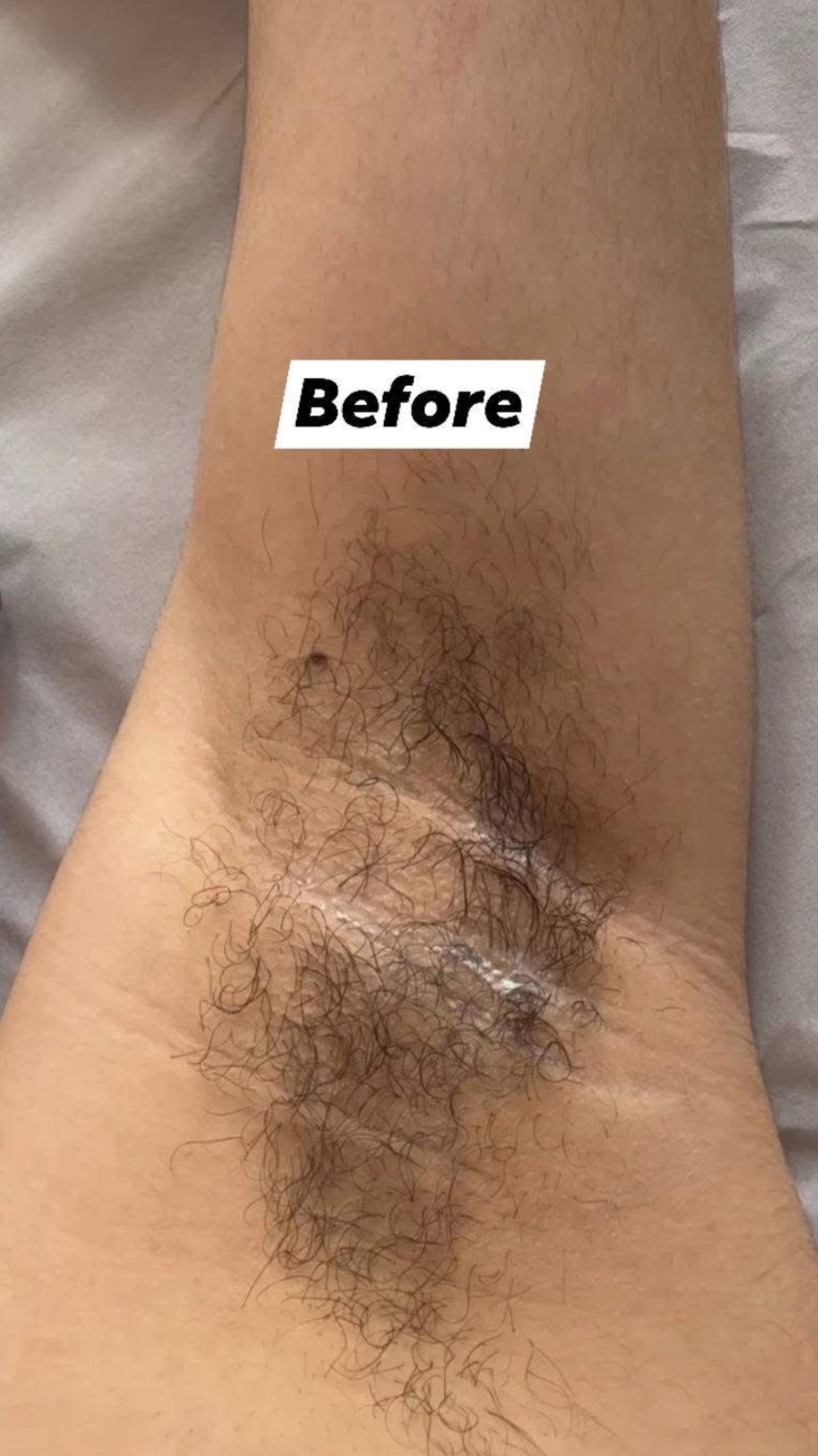 @Women armpit lovers