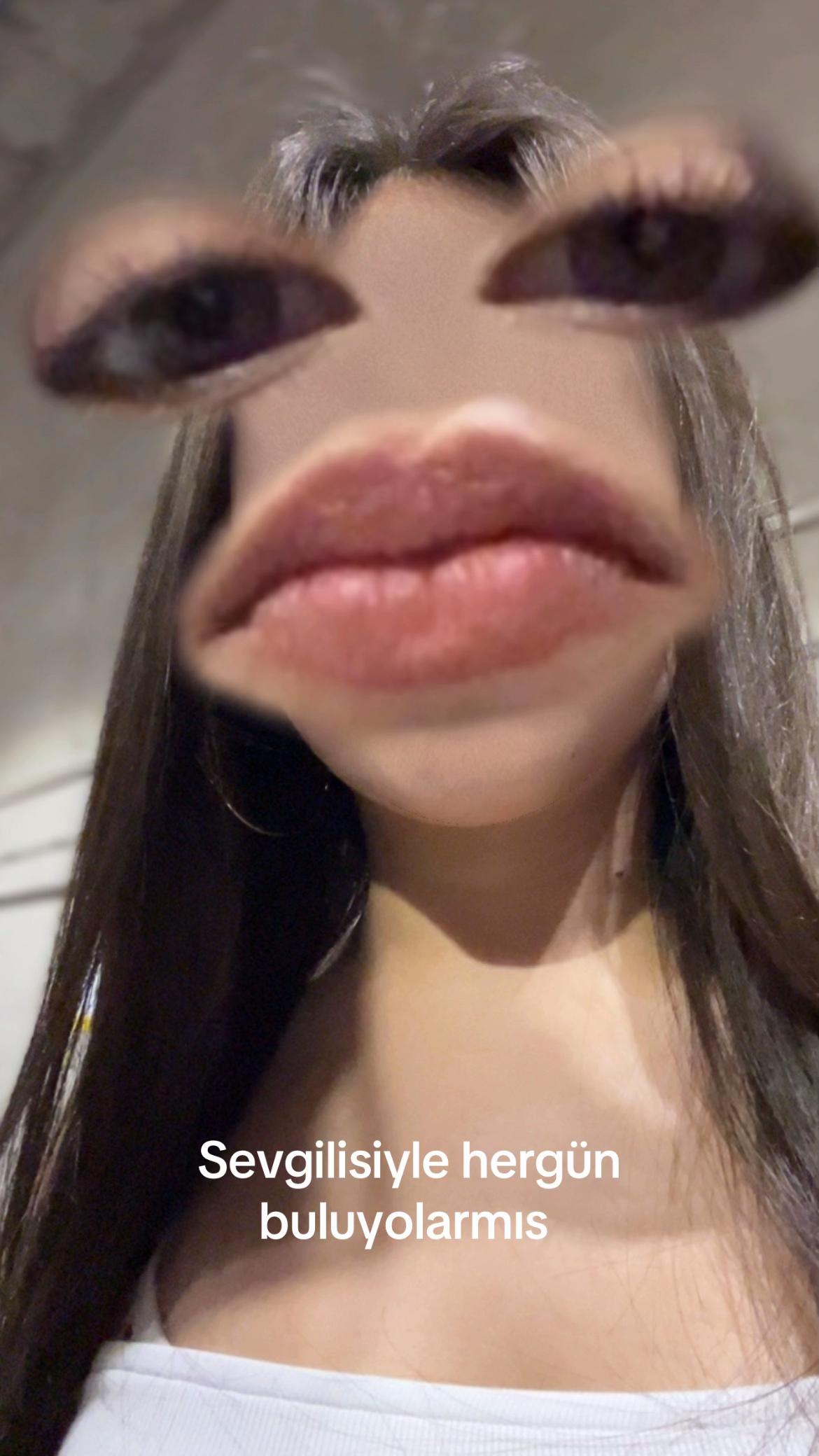 @spastiknunus21