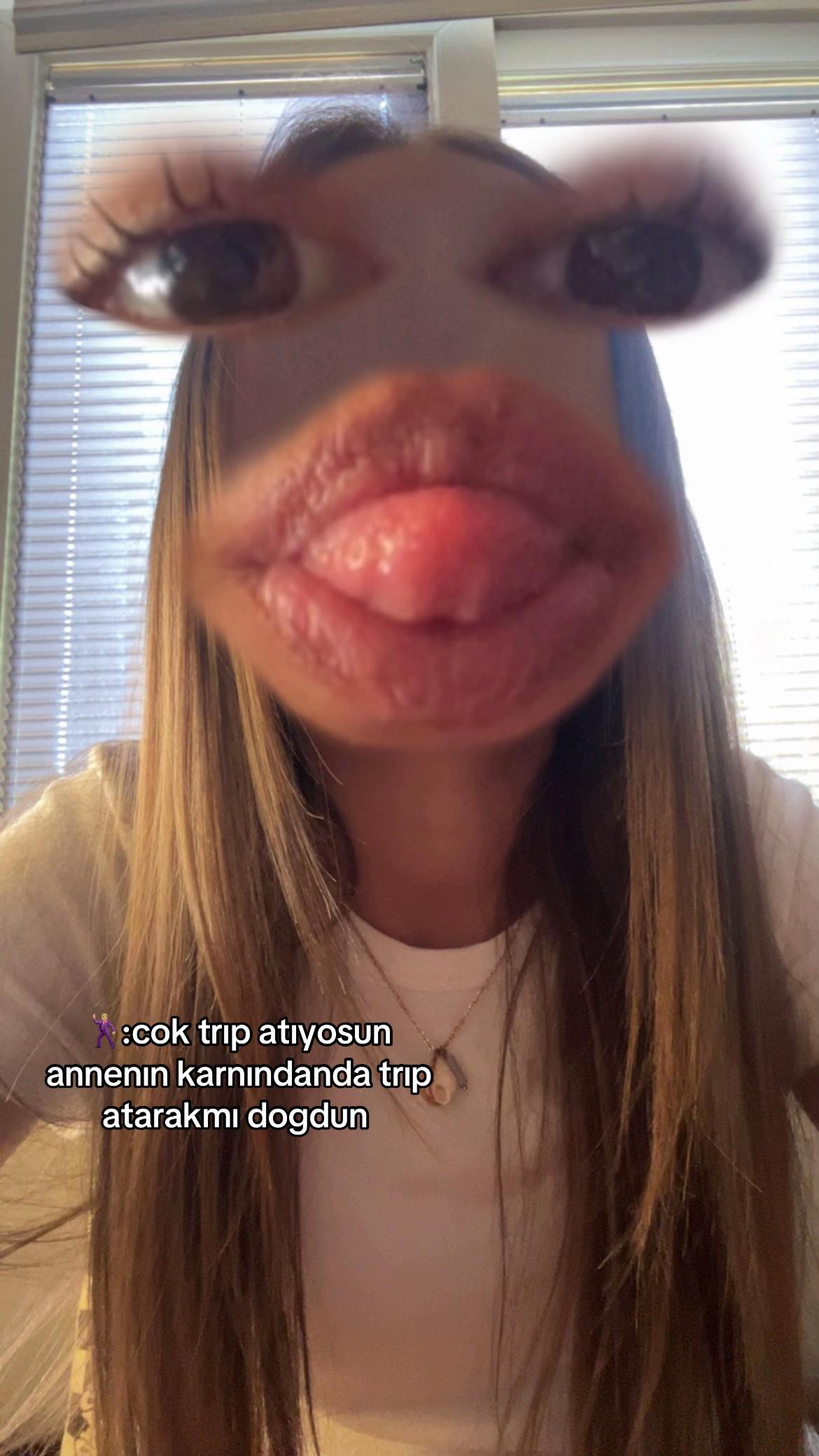 @🐿️