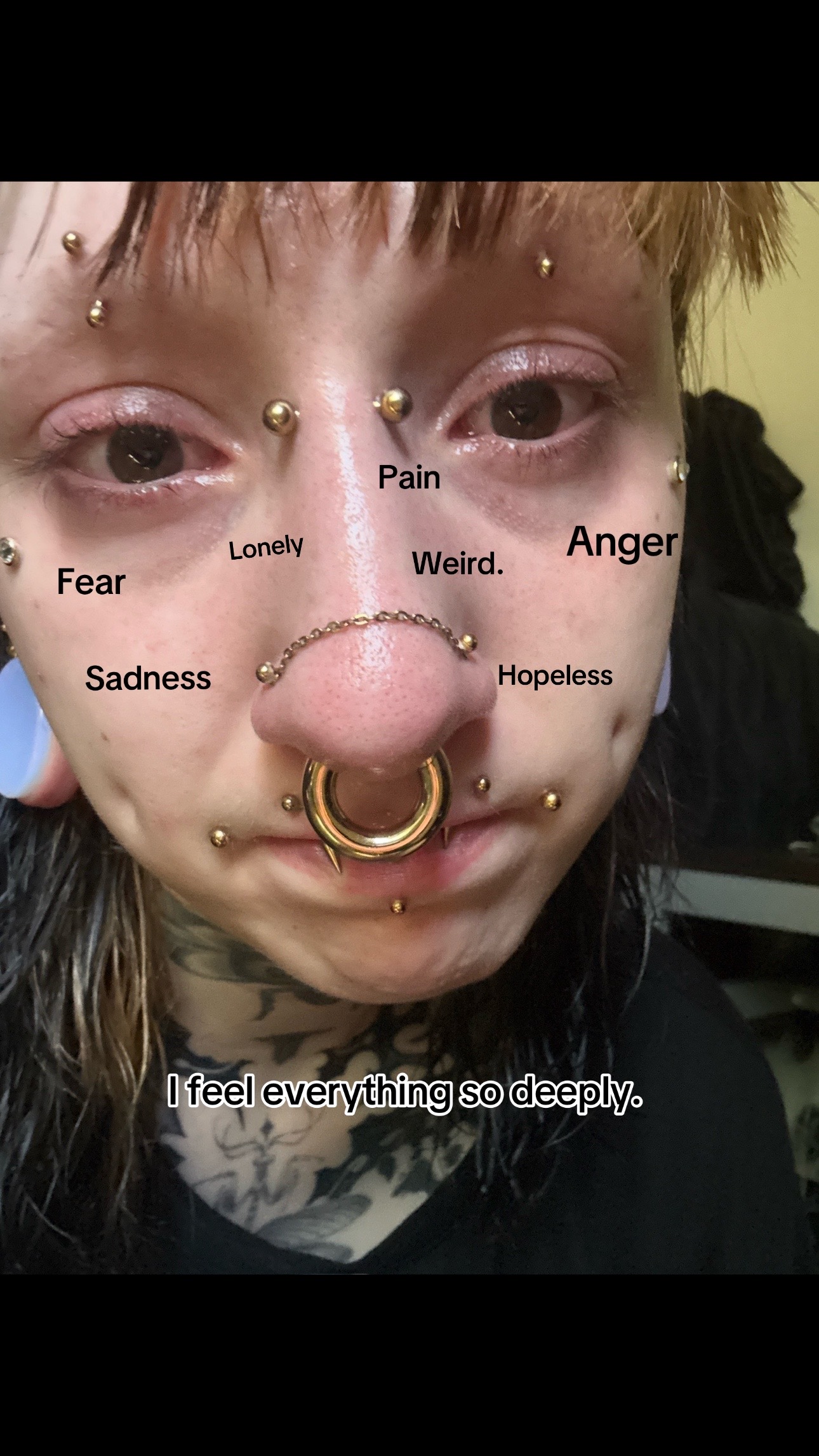 @ems🐞