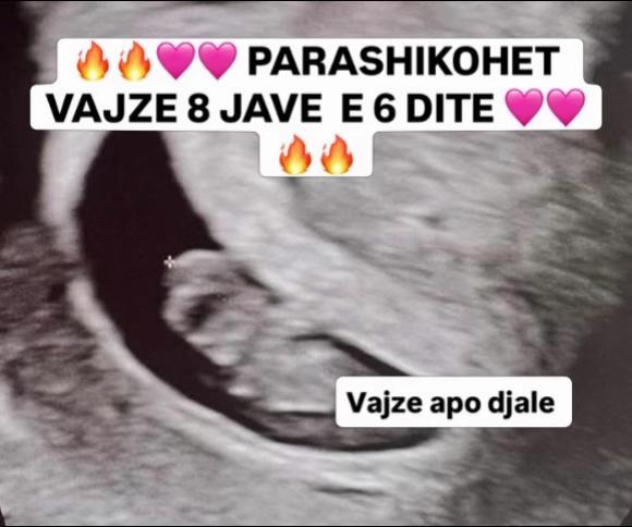 @Vajze apo Djale? 💙💖