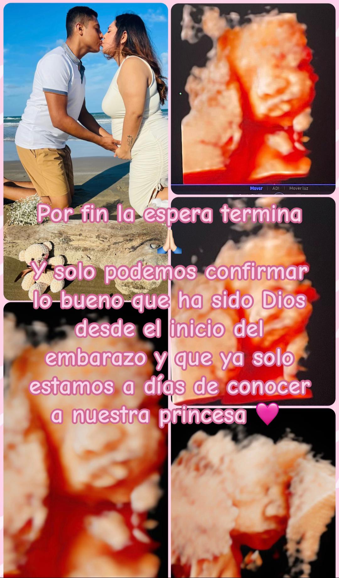 @Yunii Del Angeel