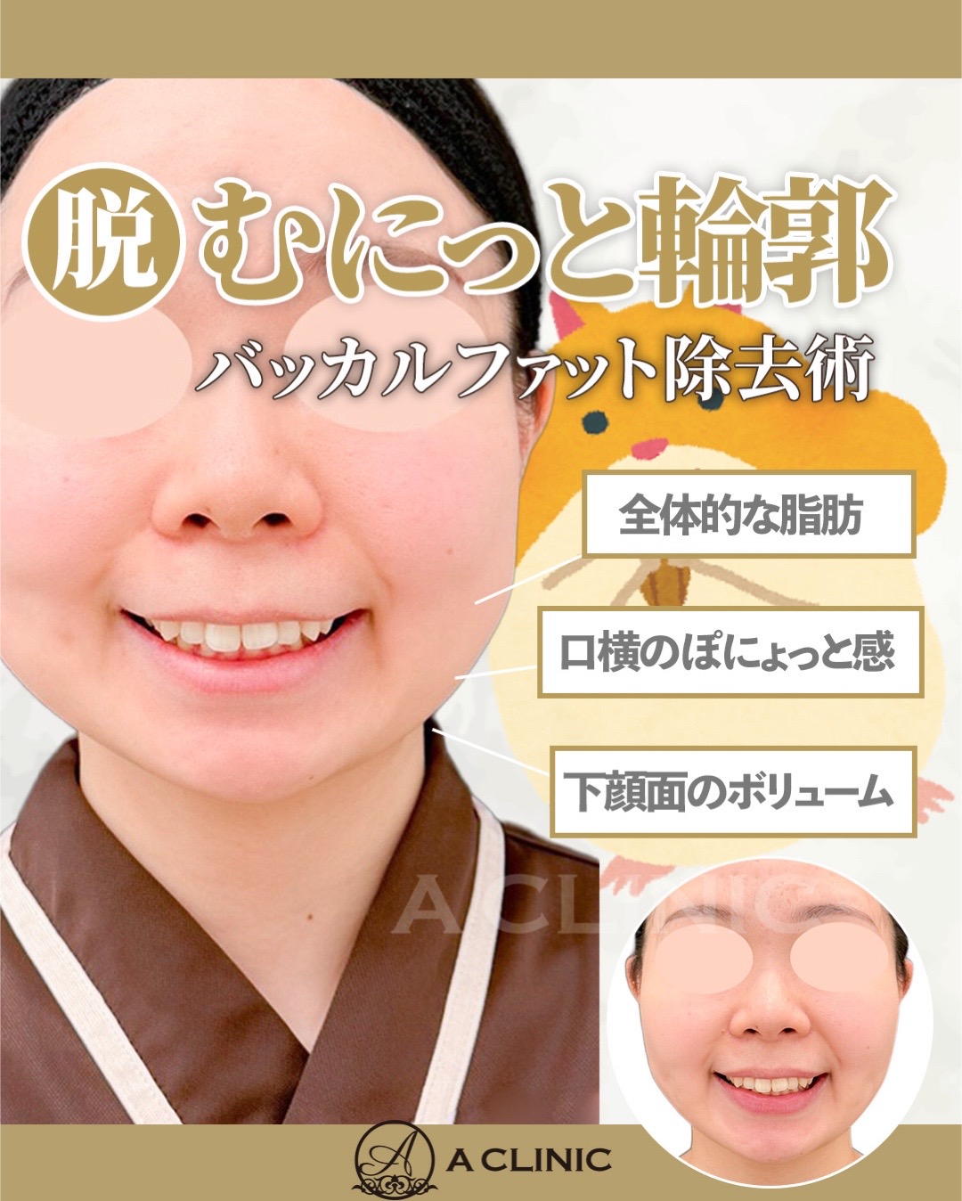 @ACLINIC池袋院【小顔/中顔面短縮】