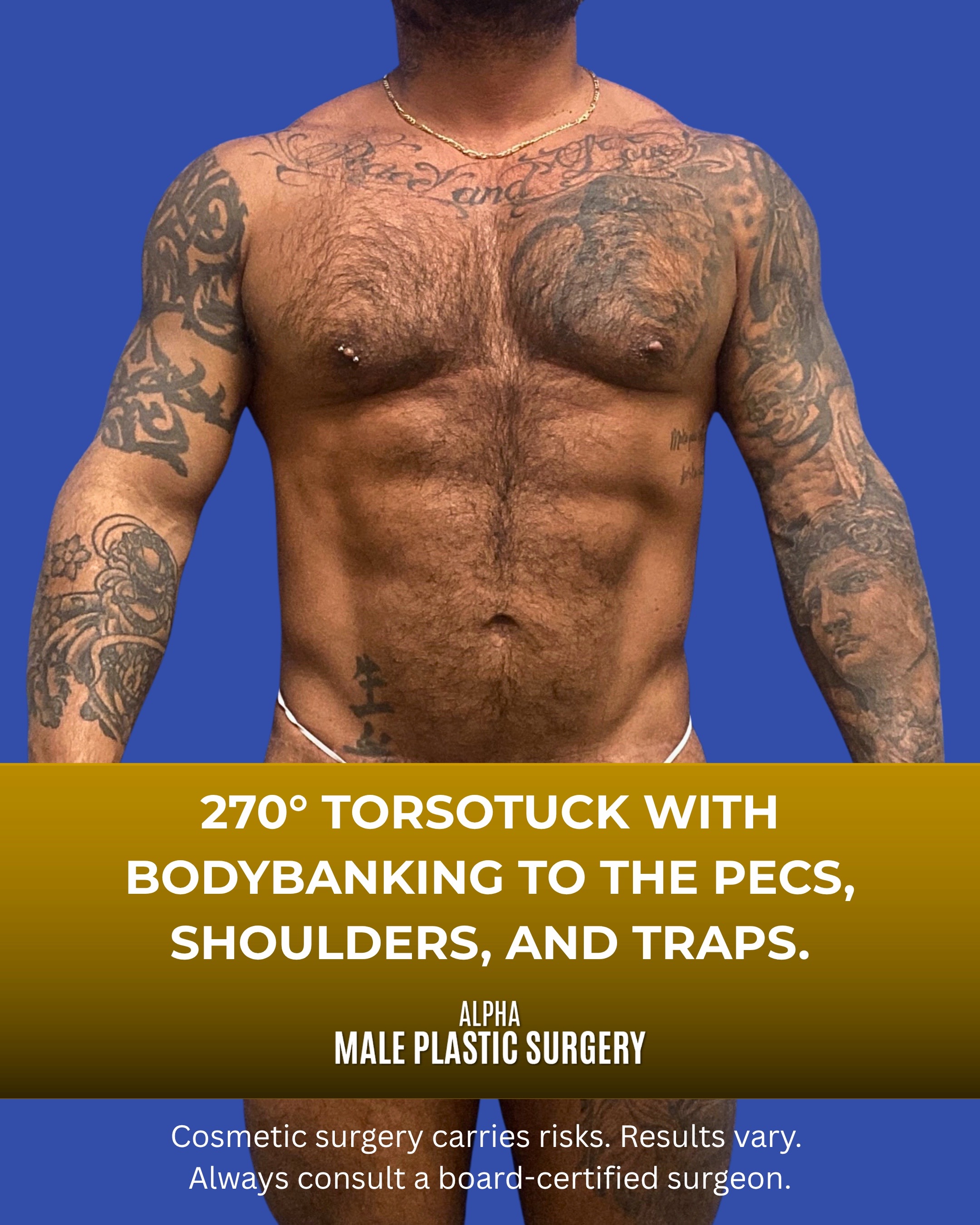 @mensplasticsurgery