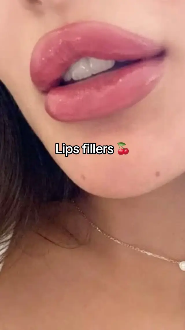 @مراس فرع النزهة