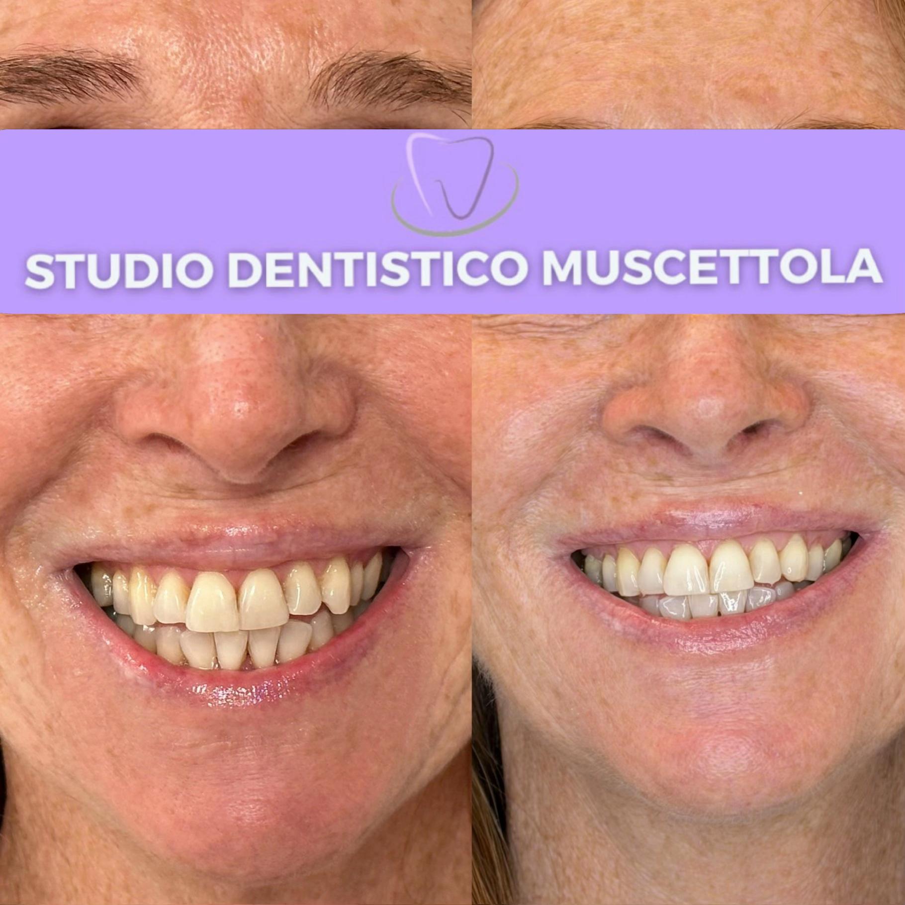 @Dott.Marta | Estetica Dentale