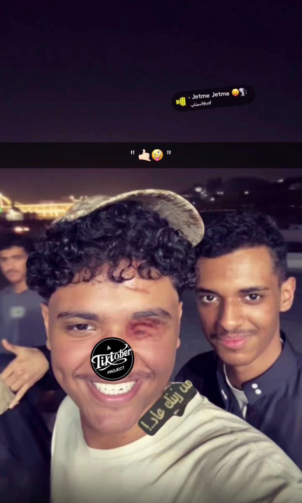 @انسان ضايع بالحرازات
