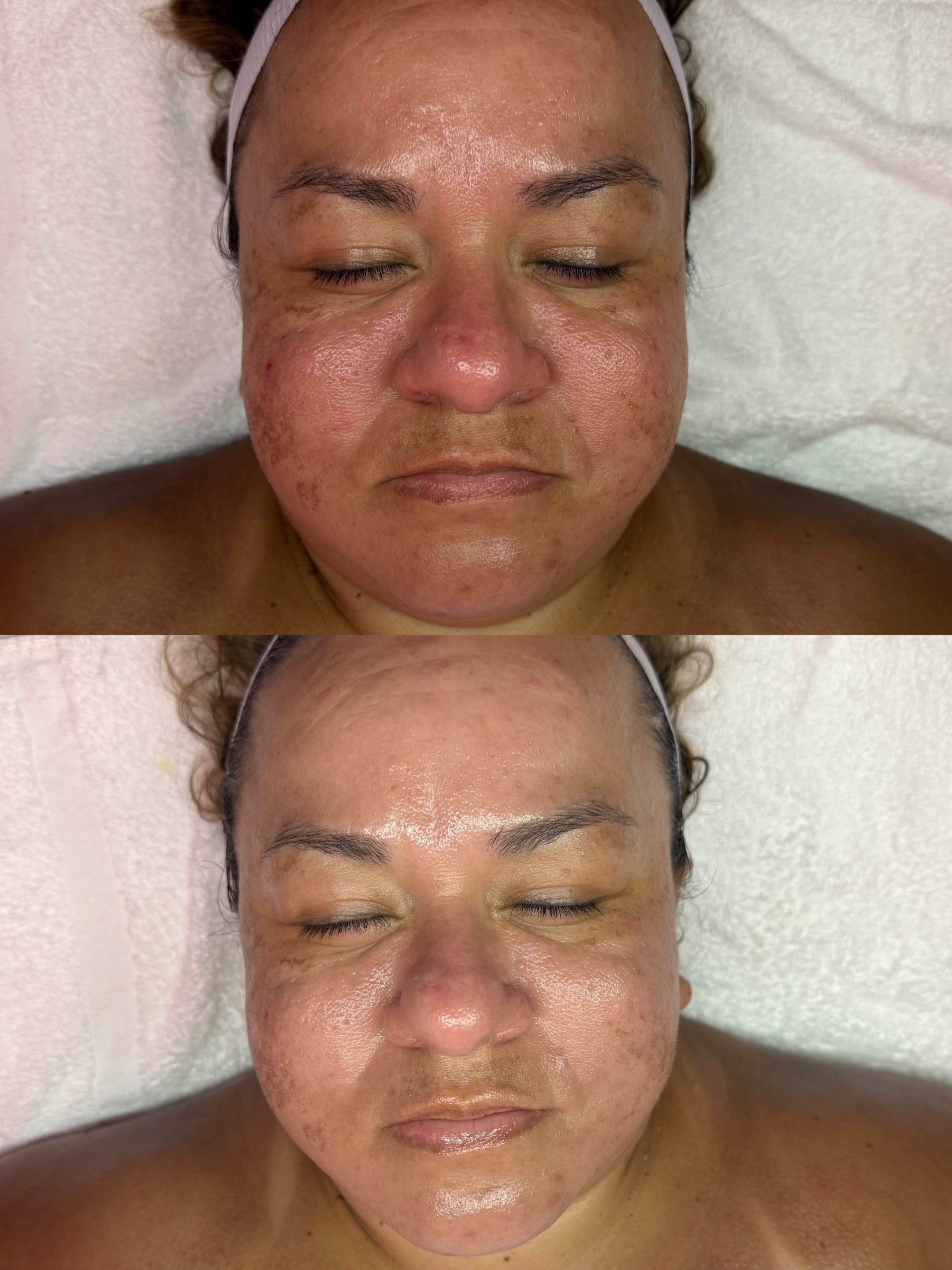 @HappySkinBySara