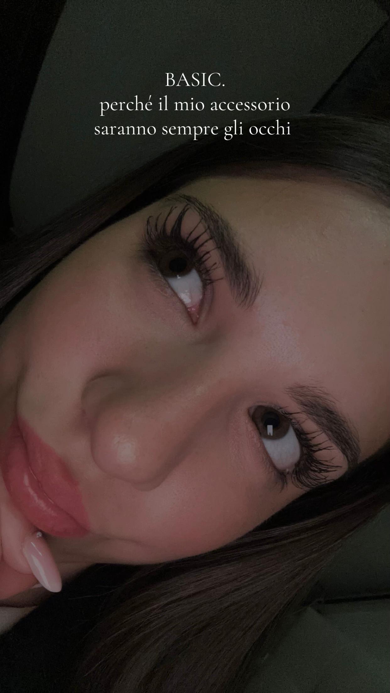 @alyx