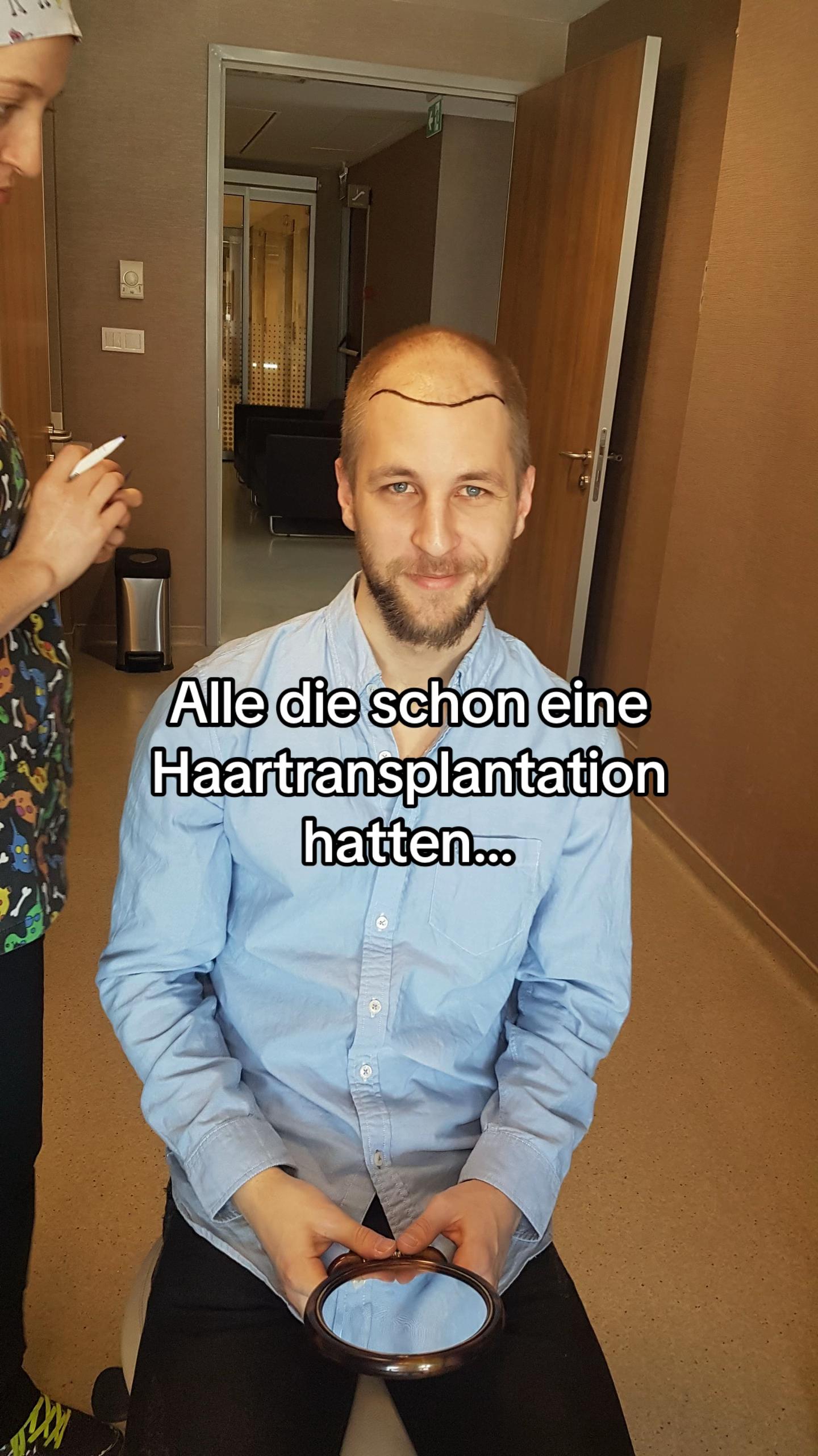 @Mr. Hairtransplant