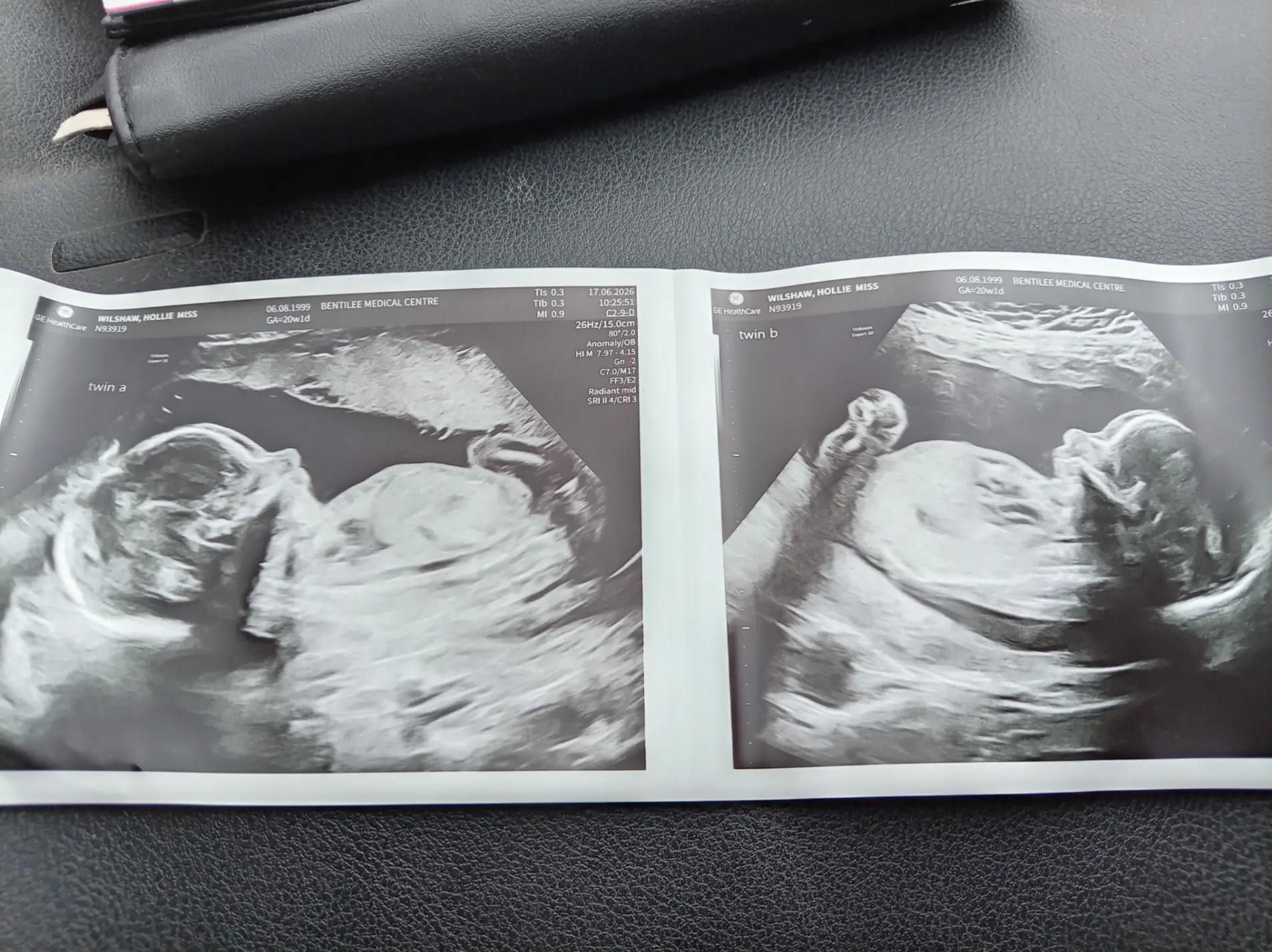 @Holsophiexx