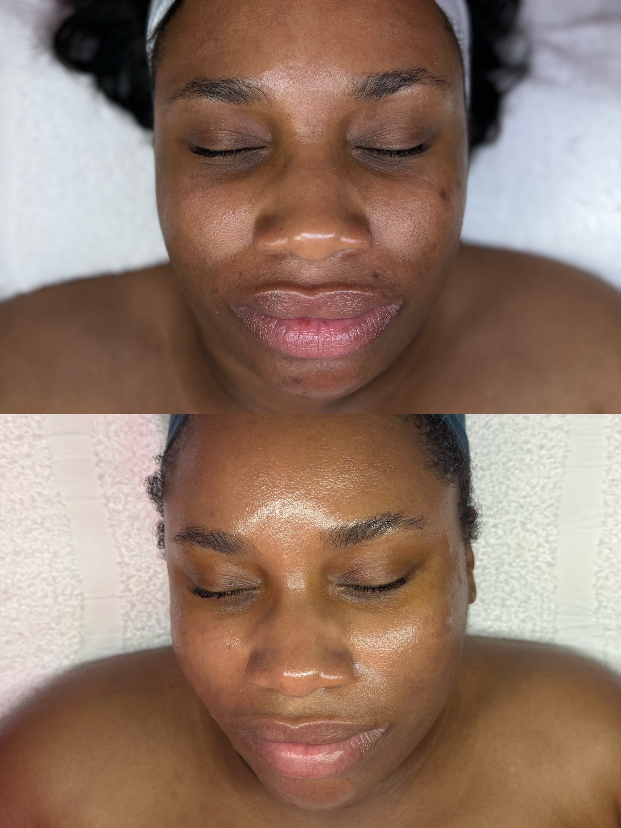 @HappySkinBySara