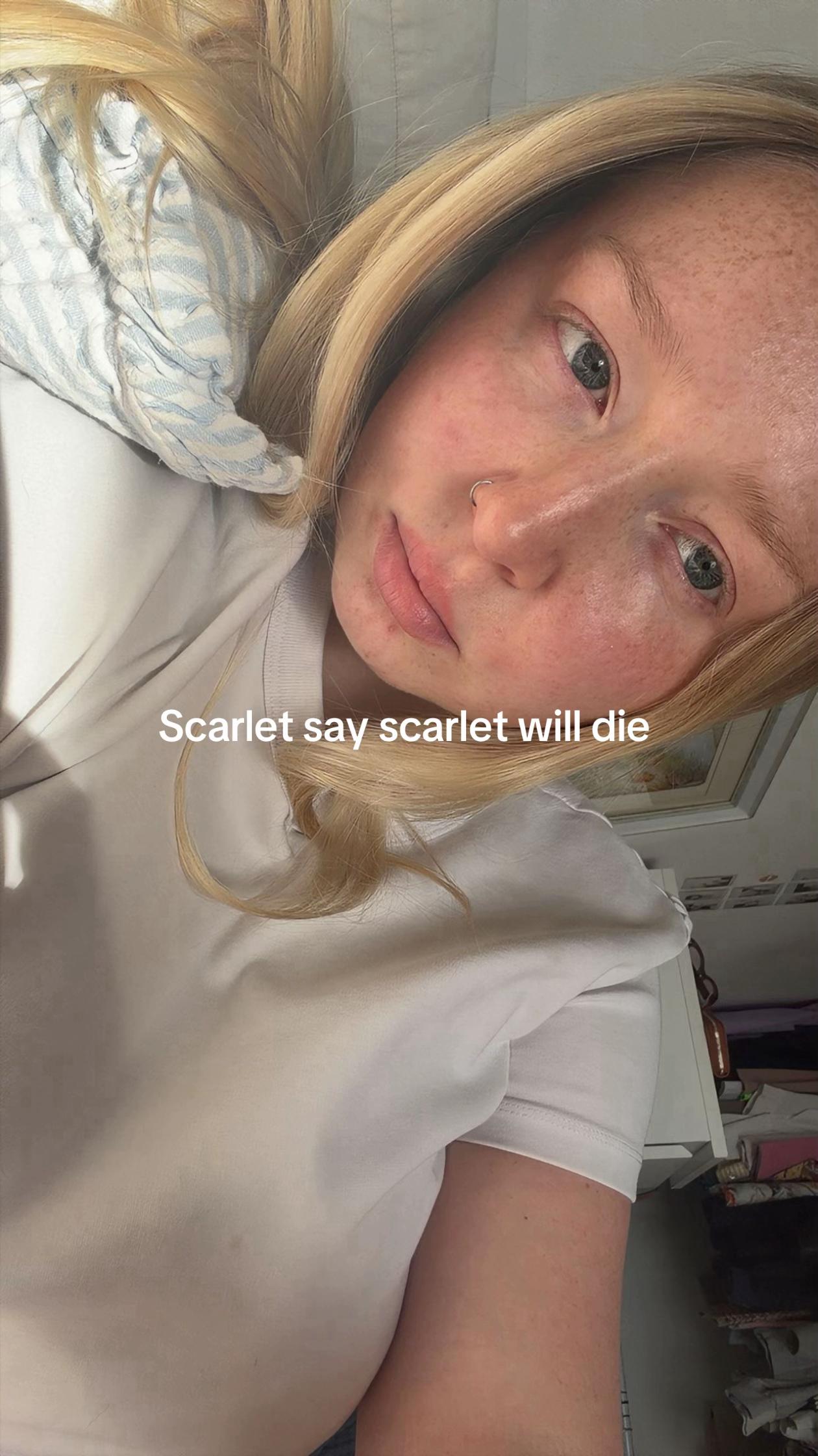 @Scarl