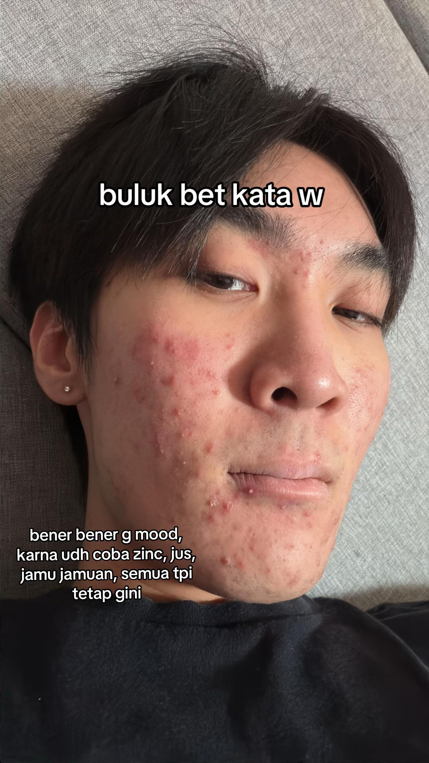 @Mau kulit sehat