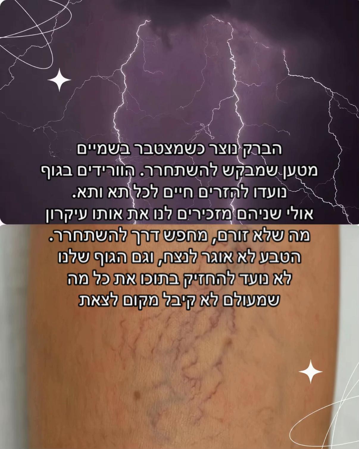 @Shoval Dabol
