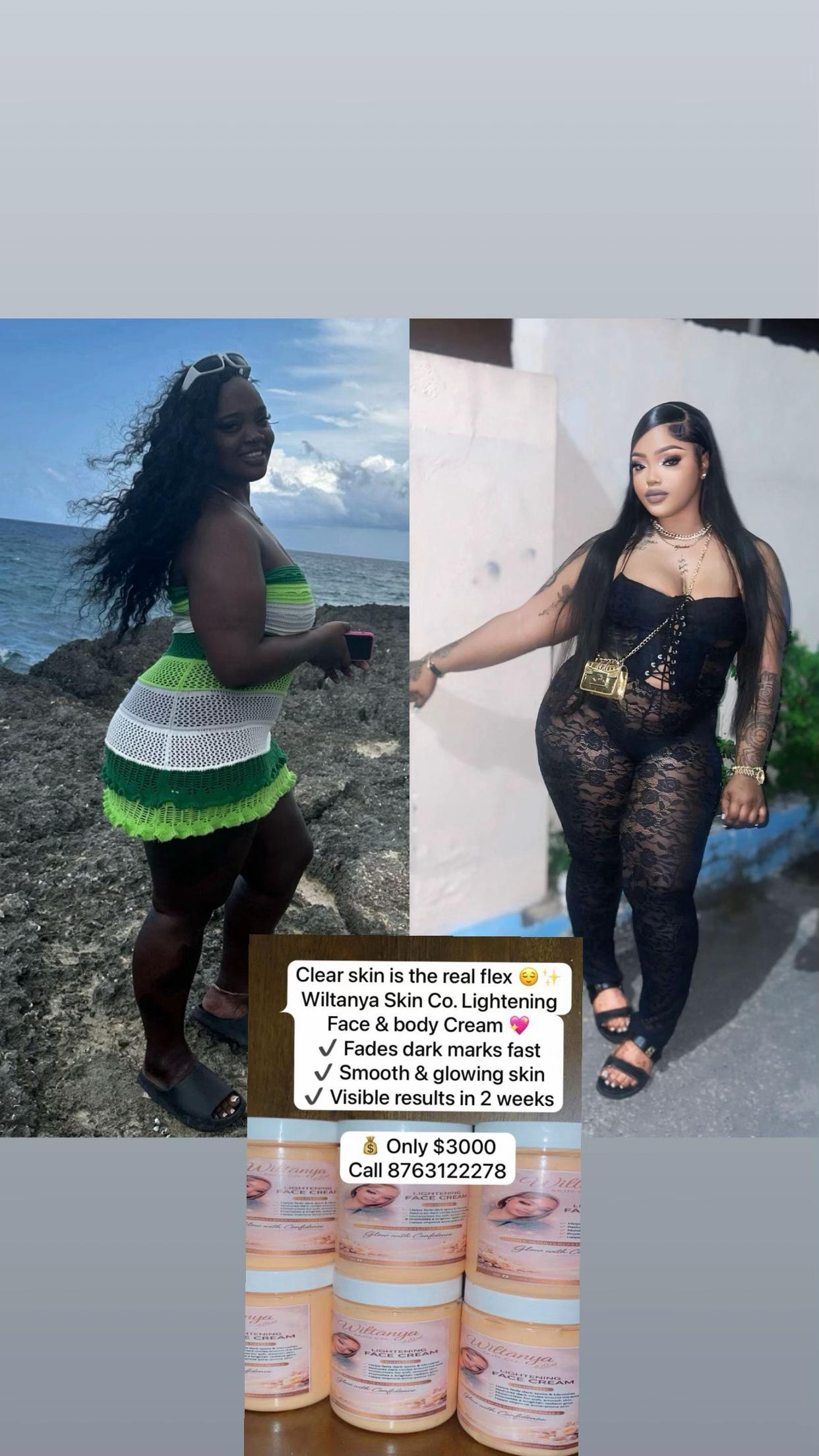 @Ateeka Williams