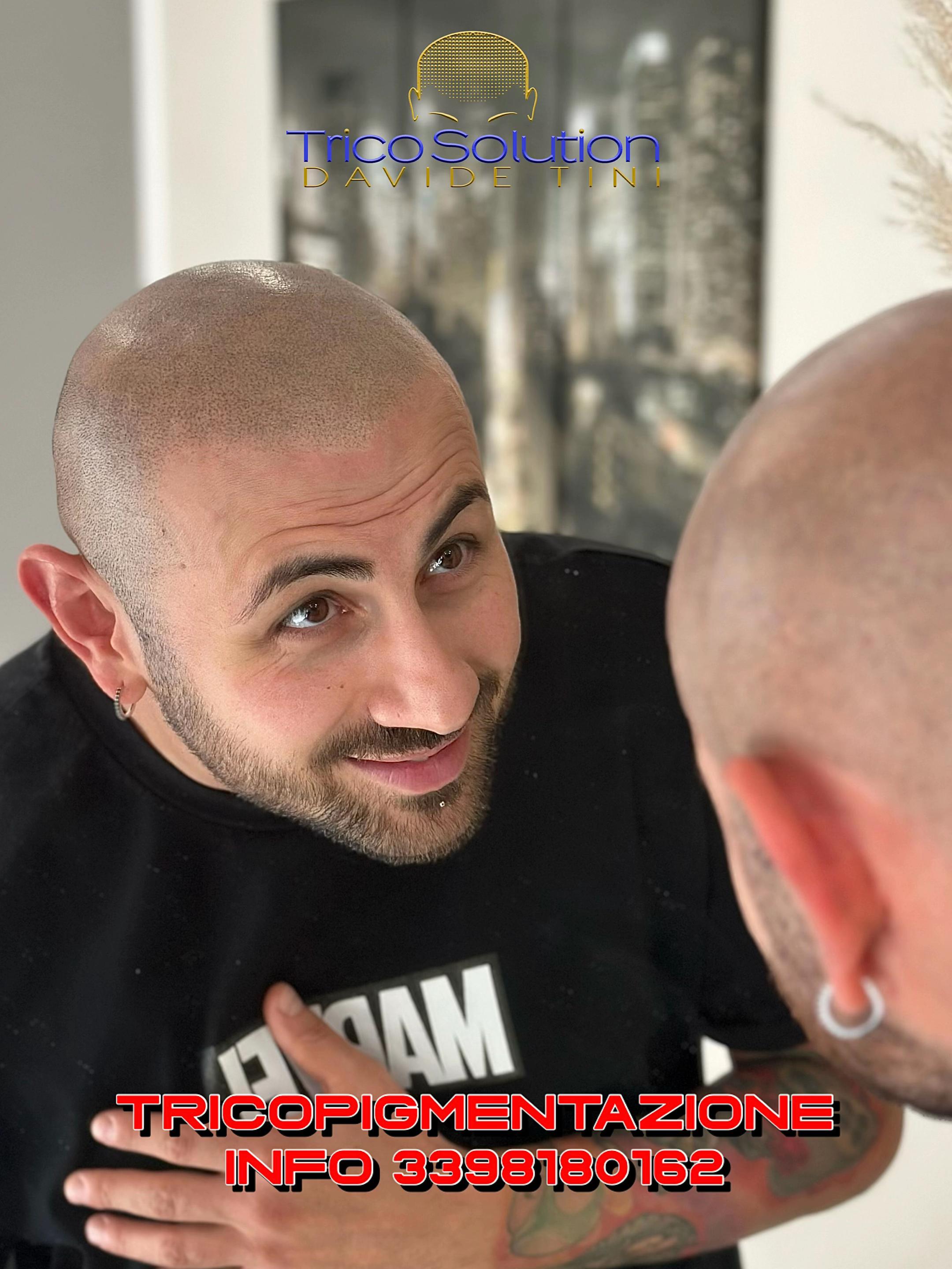 @TricoSolution di Davide Tini
