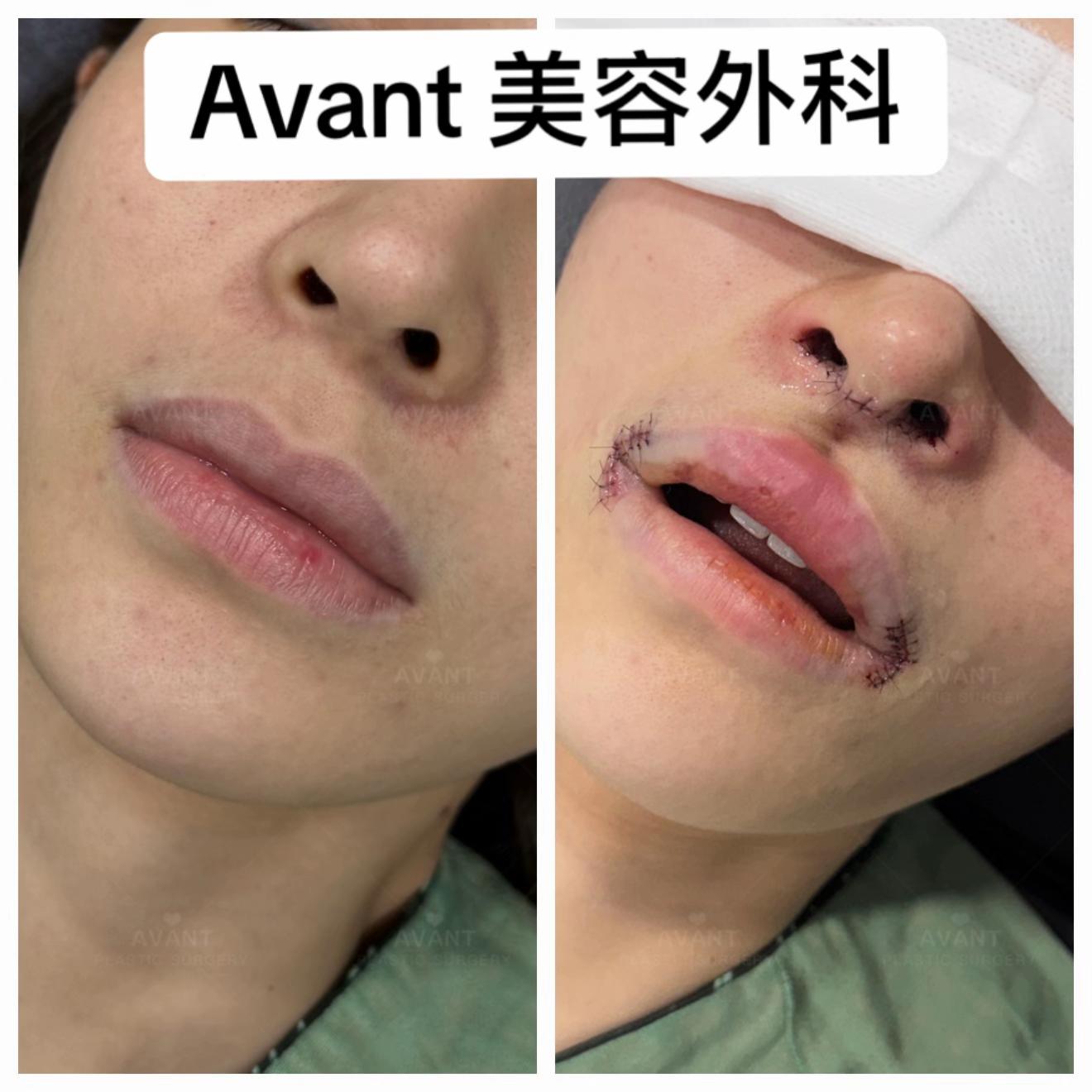 @Avant美容外科