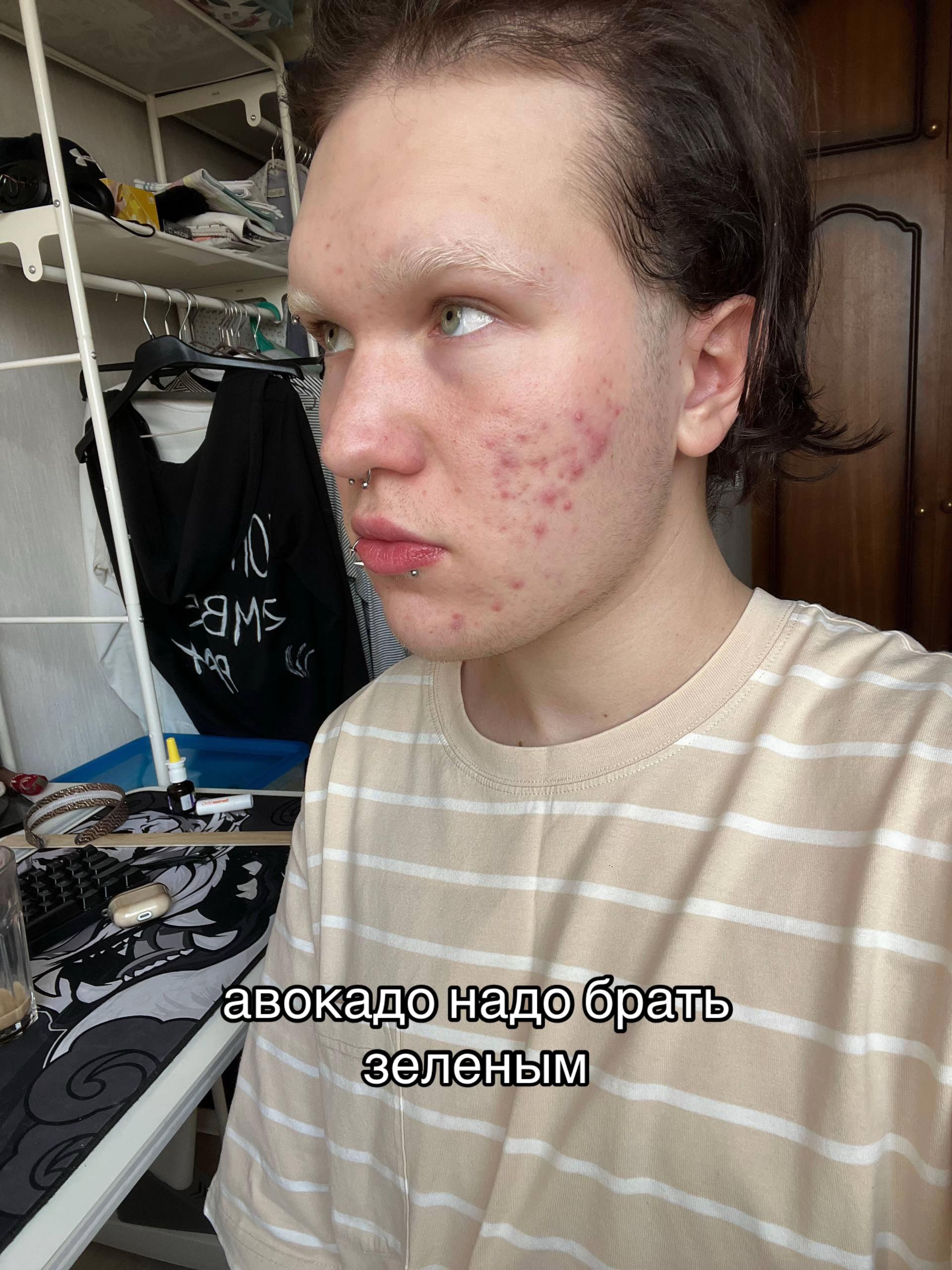 @мэтью соевый нормис