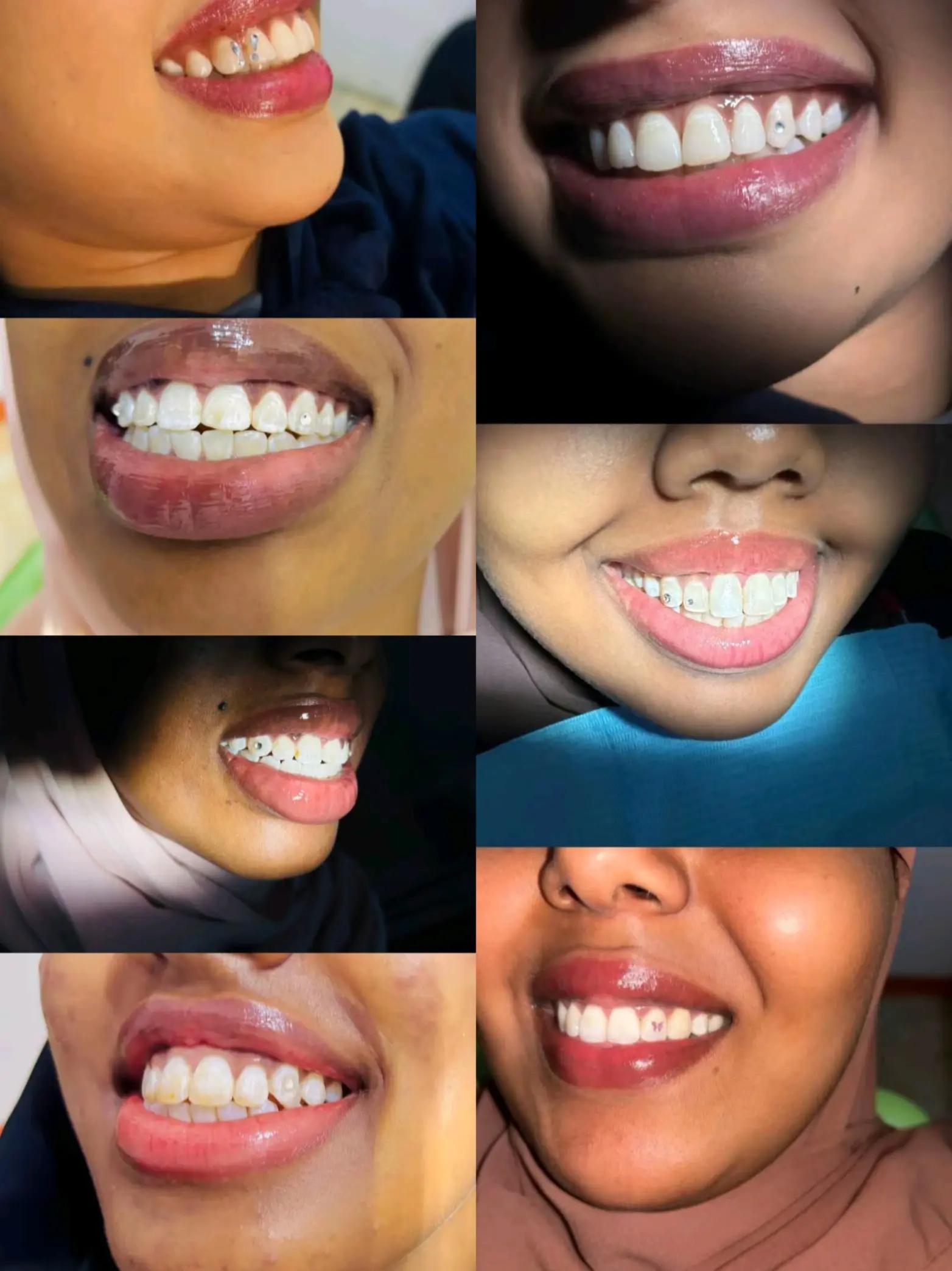 @Dr.Naasir🦷🩵🩺