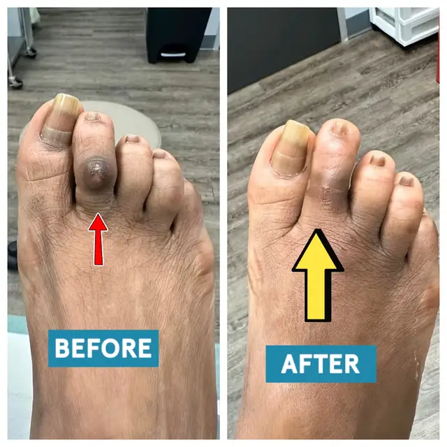 @Deniel Foot and Ankle Center