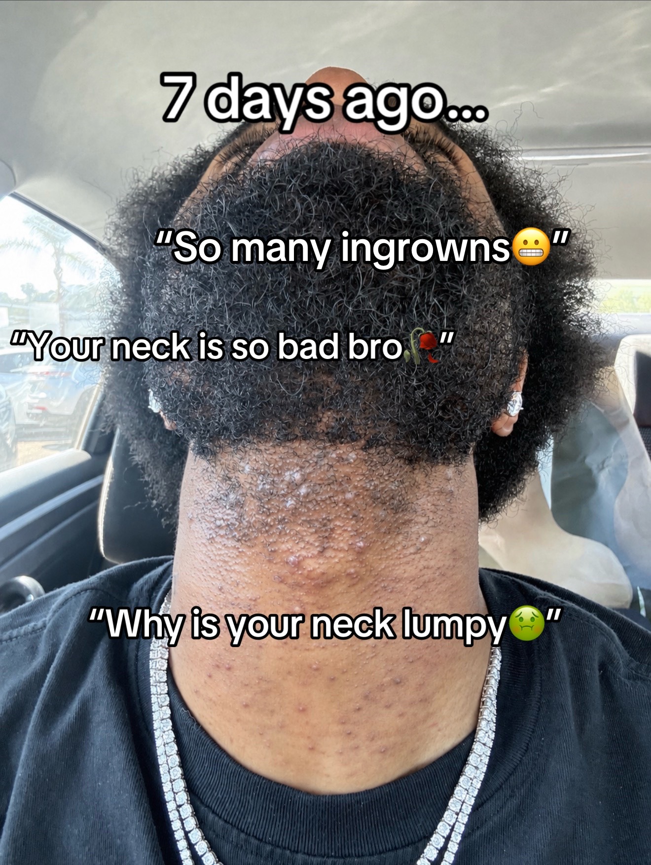 @Imtredarius