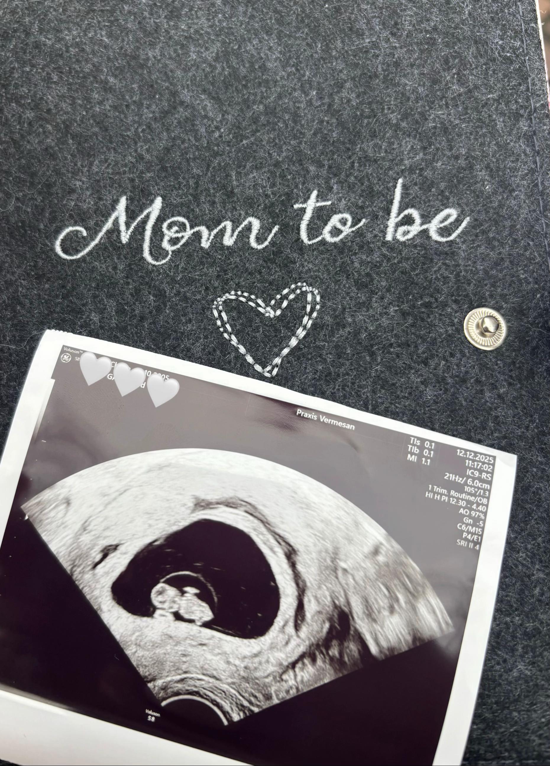 @chiara | mommy of 2🩷🩷