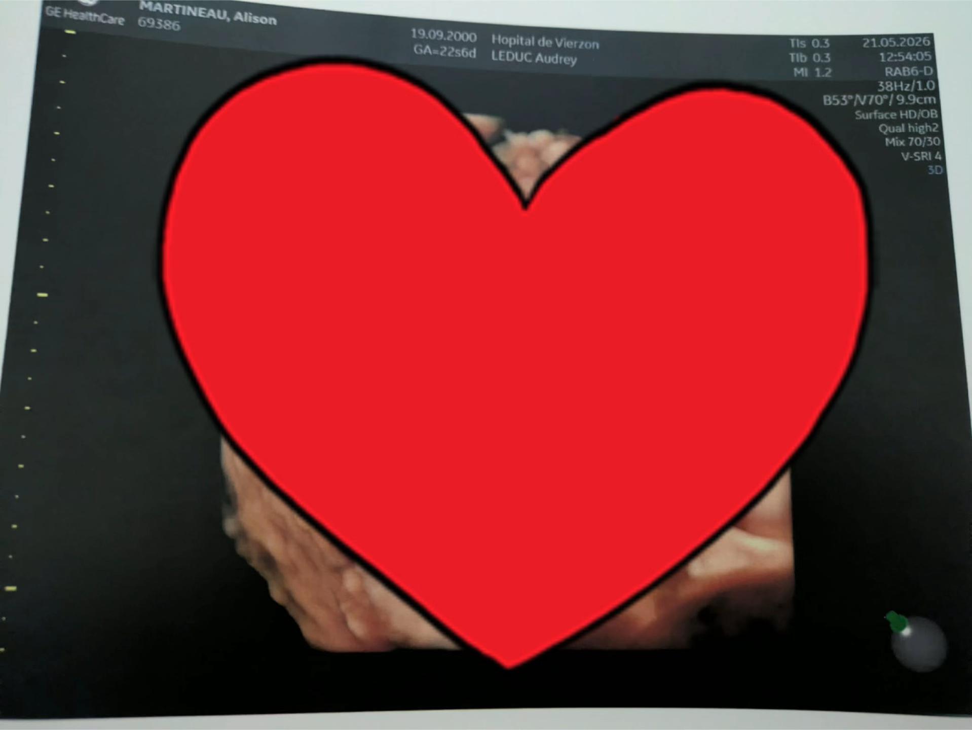 @Alison Annaëlle