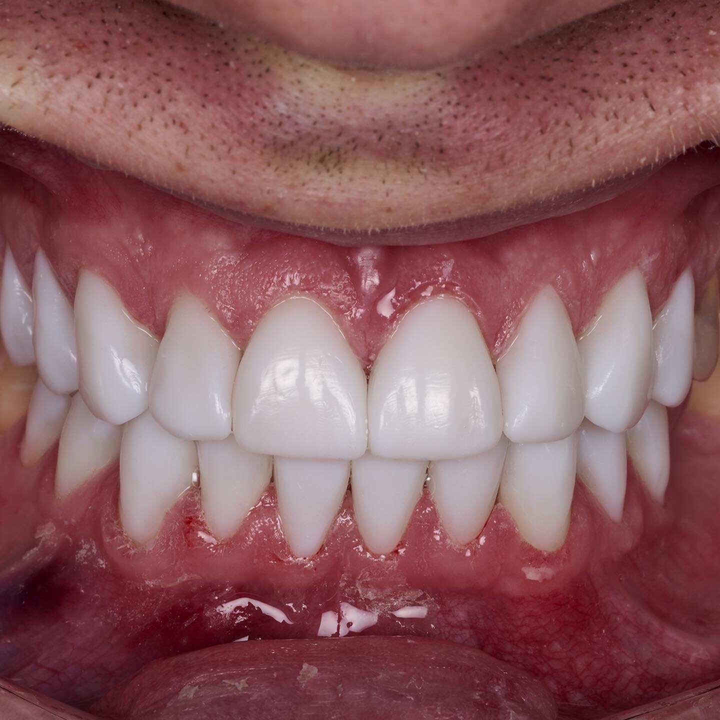 @Anna 🦷 dentystka