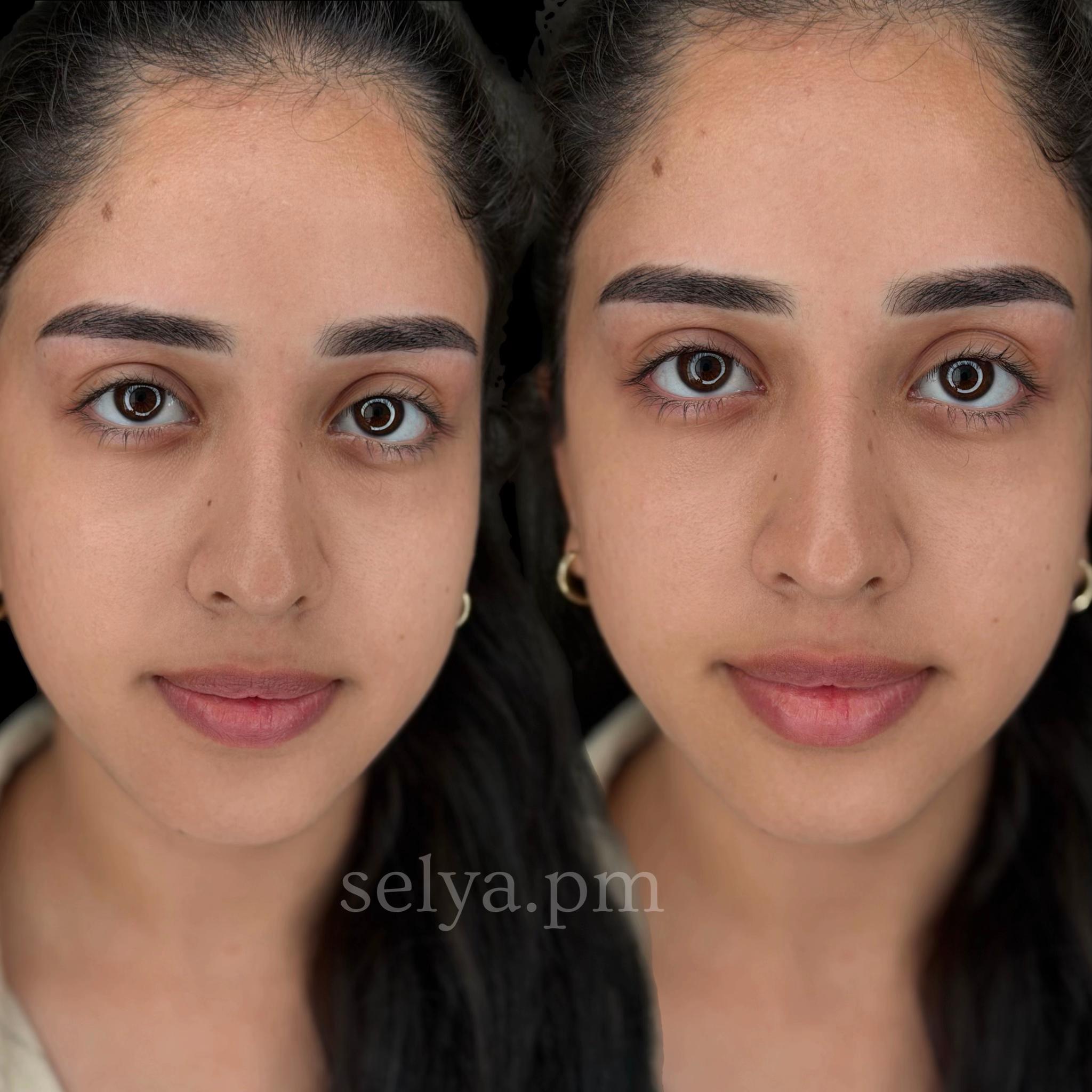 @selya.pm