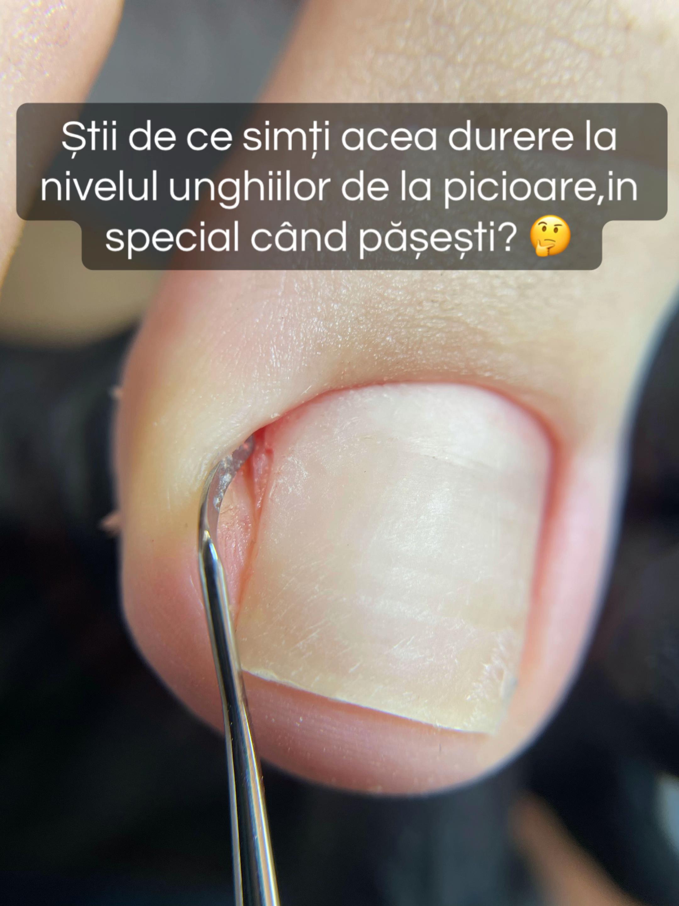 @Ana Buzea