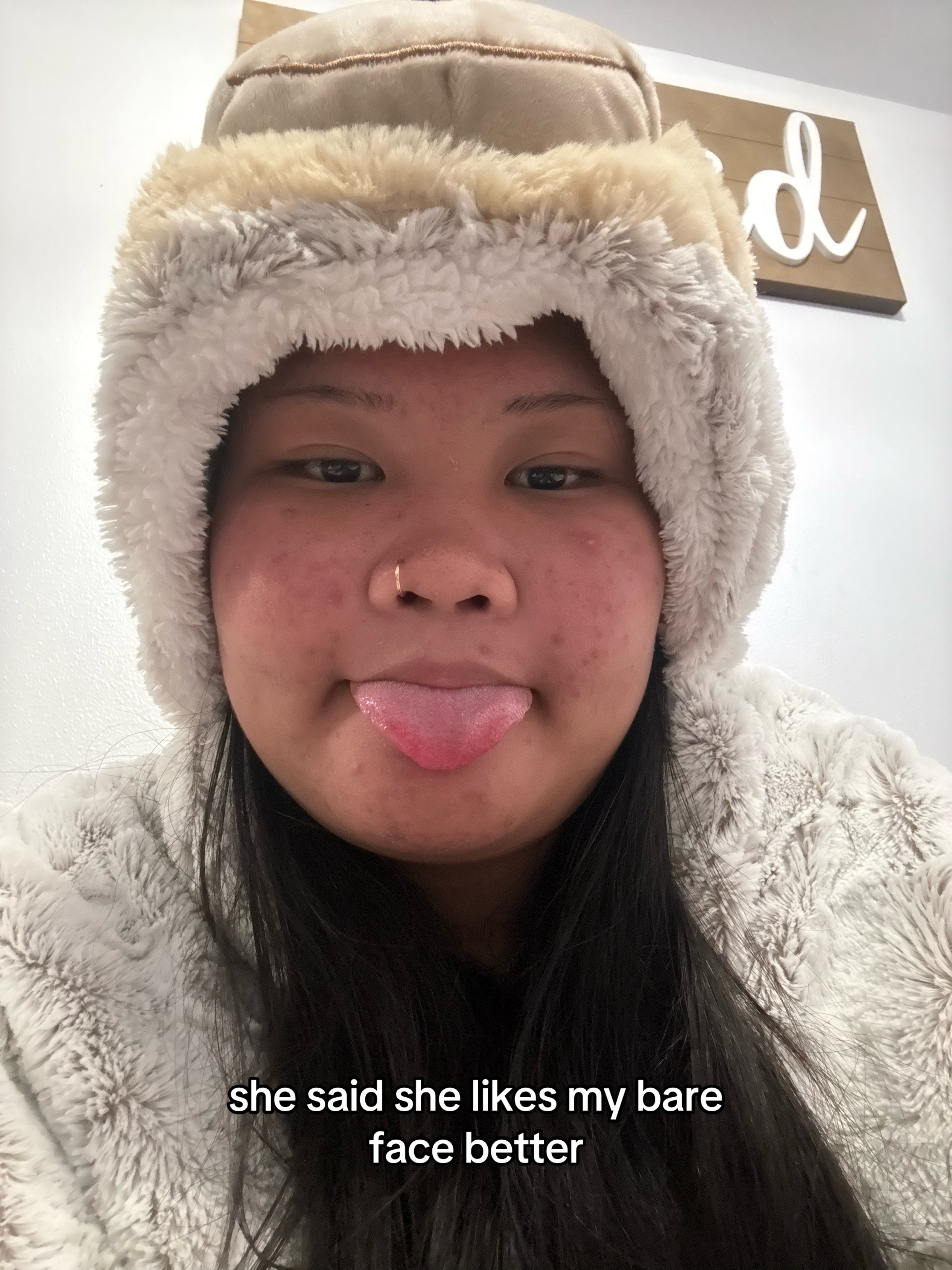 @rhi