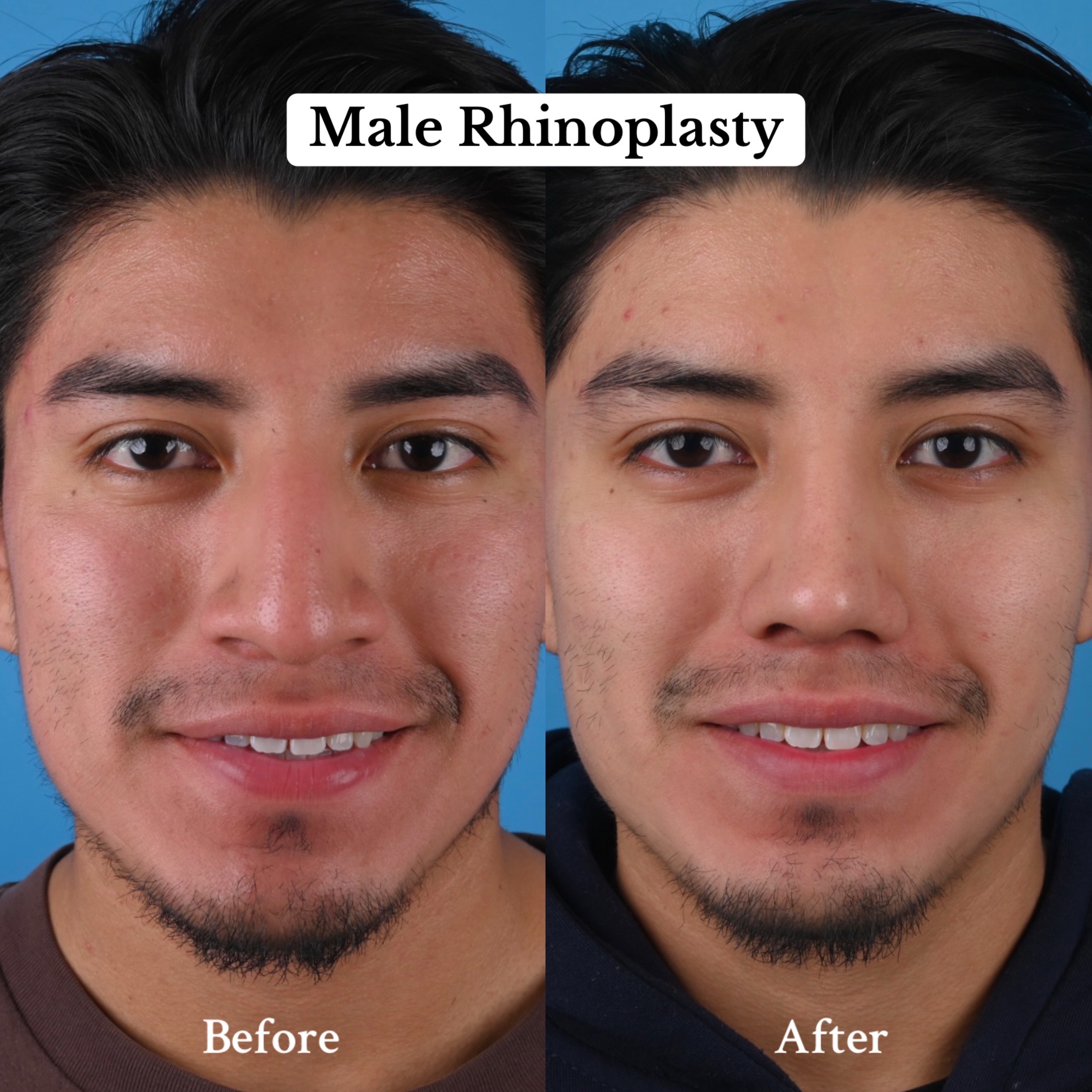 @Dr. Parit Patel, MD