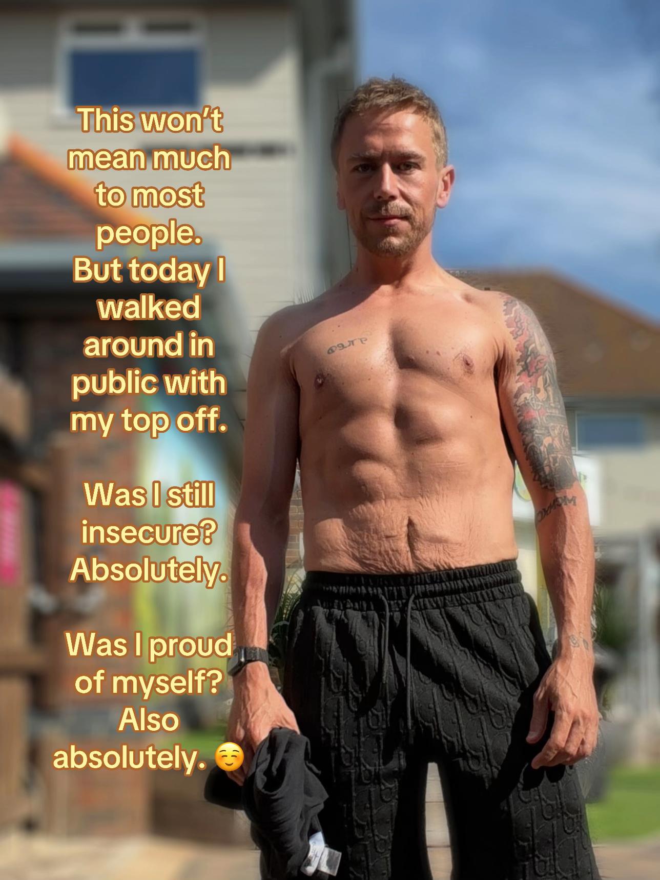 @KD | Life After Weight Loss