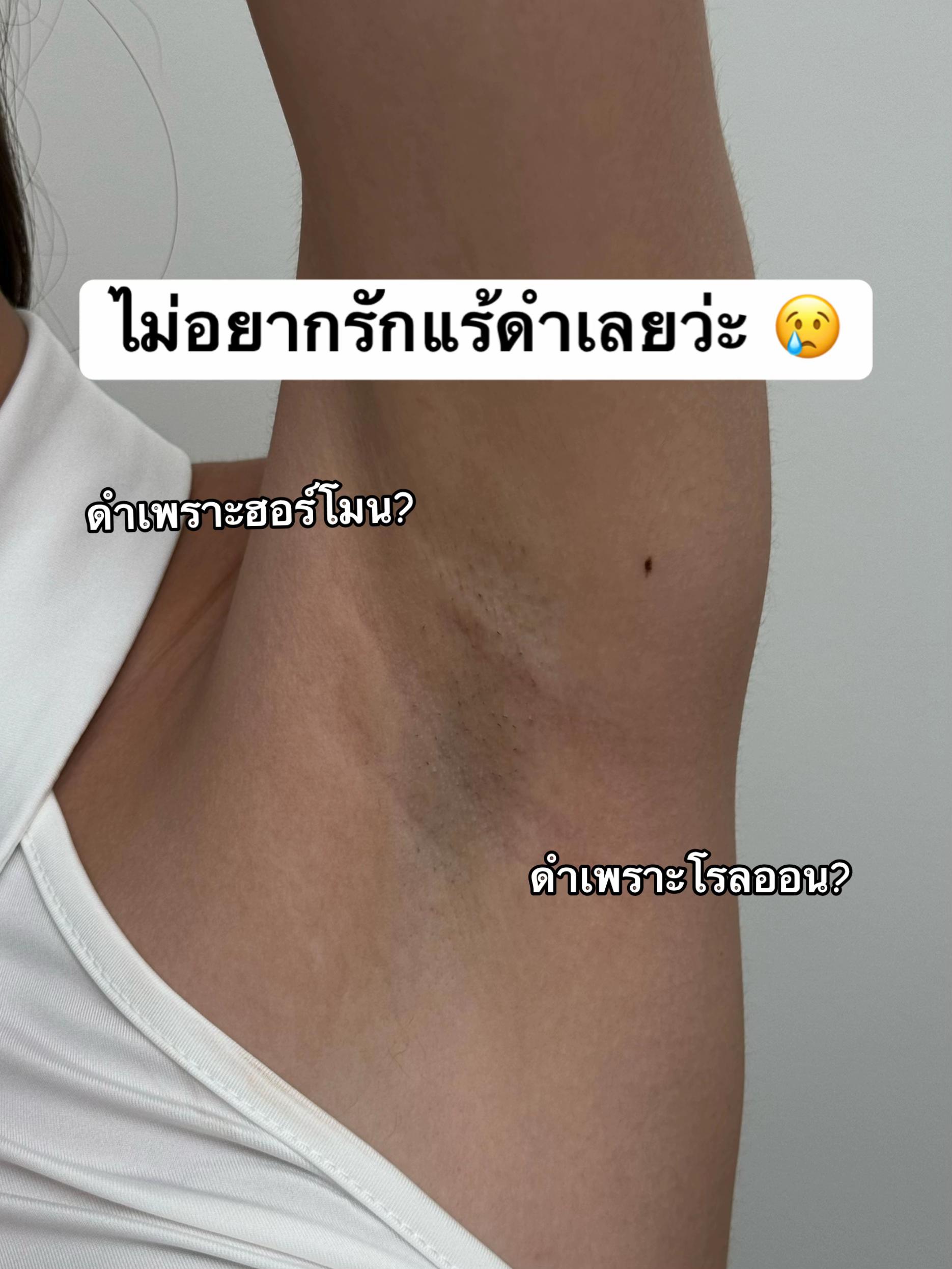 @APEXYOUNGCLINIC