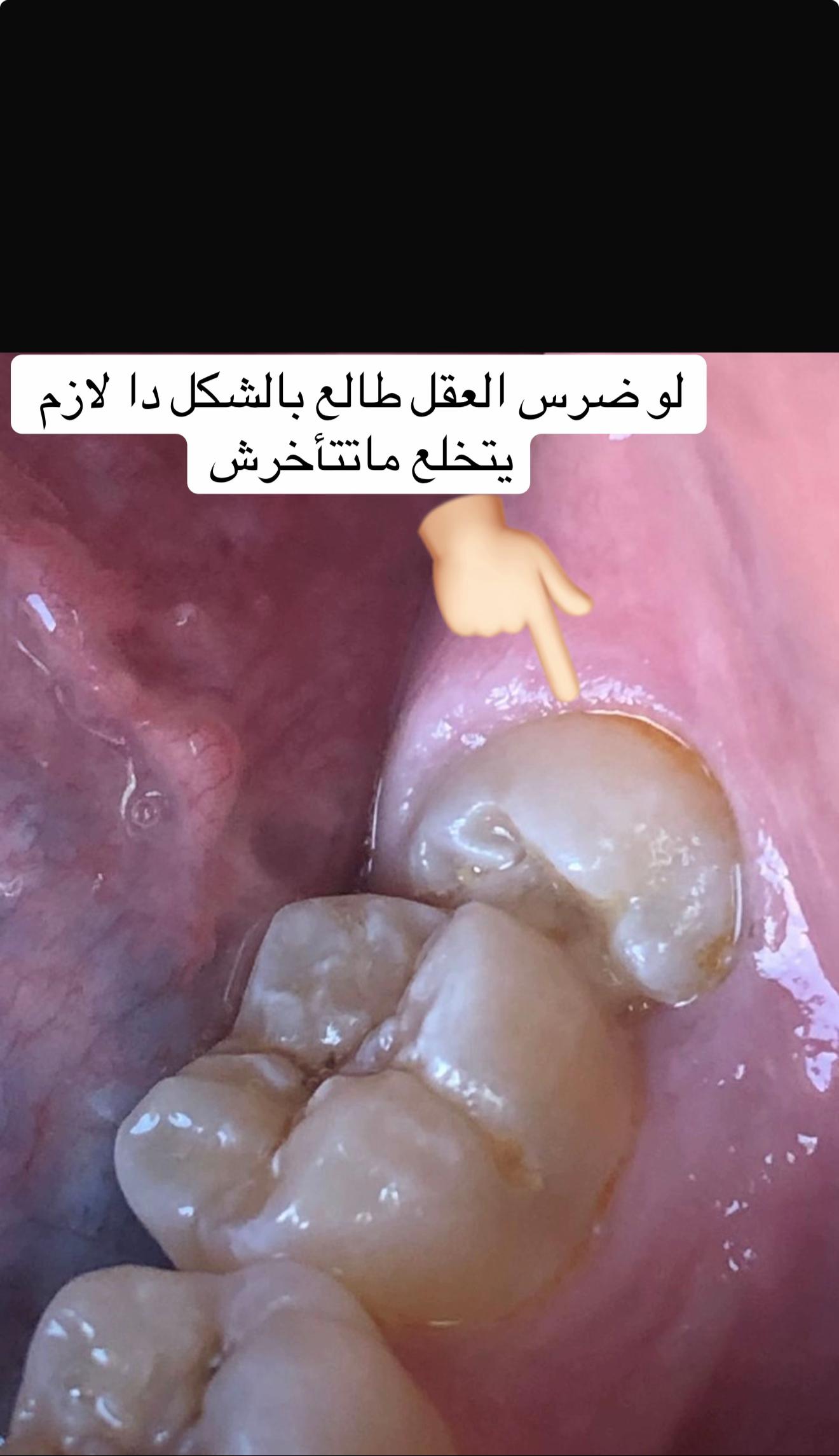 @Dr.Manar Samy