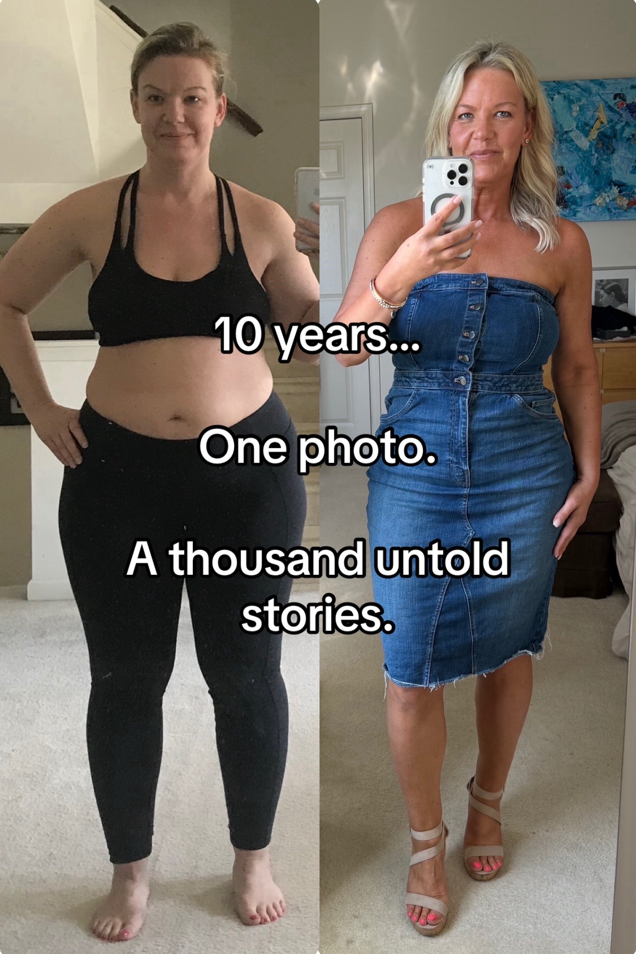 @Lipedema Warrior