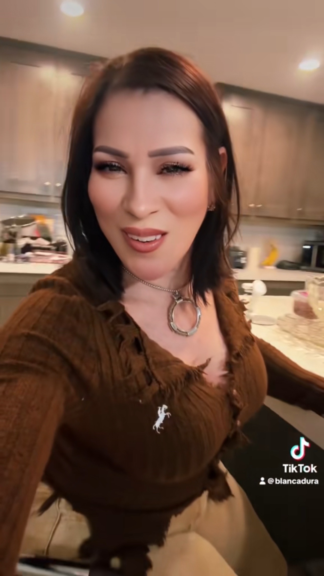 @🎀blankita💝de Chihuahua 🎀