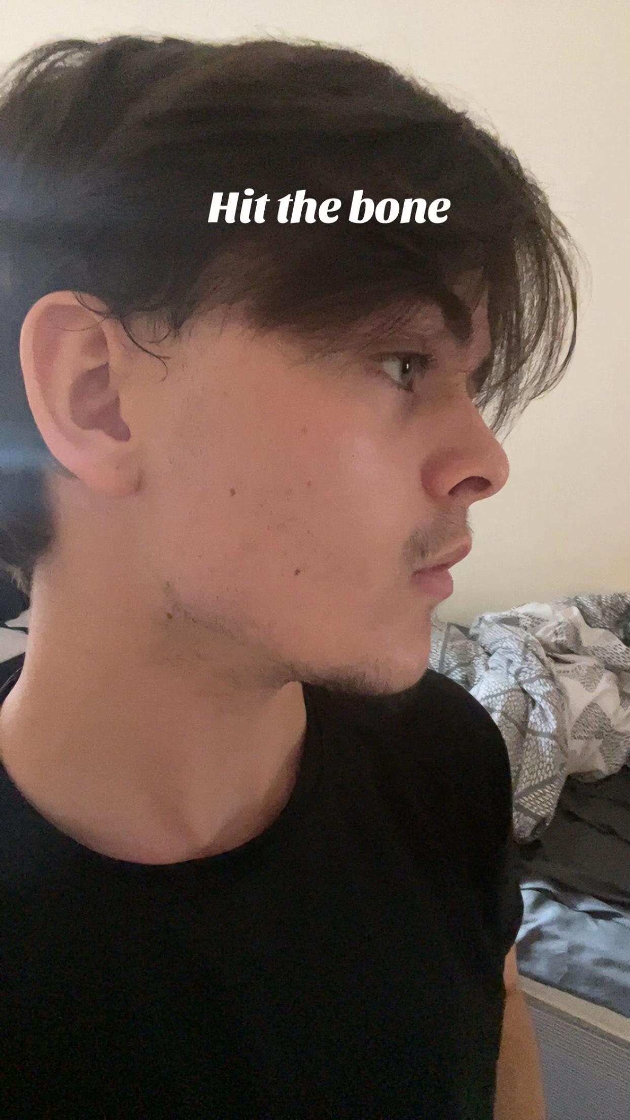@A