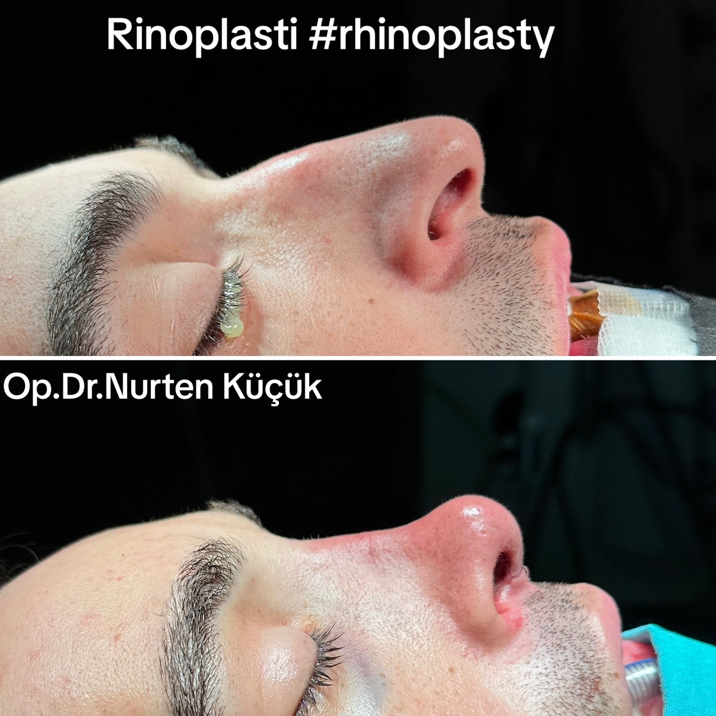 @Dr. NurtenKucuk